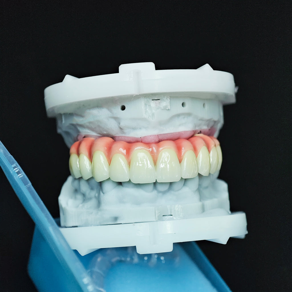 Zirconia-Enamel Hybrid Malo Bridge