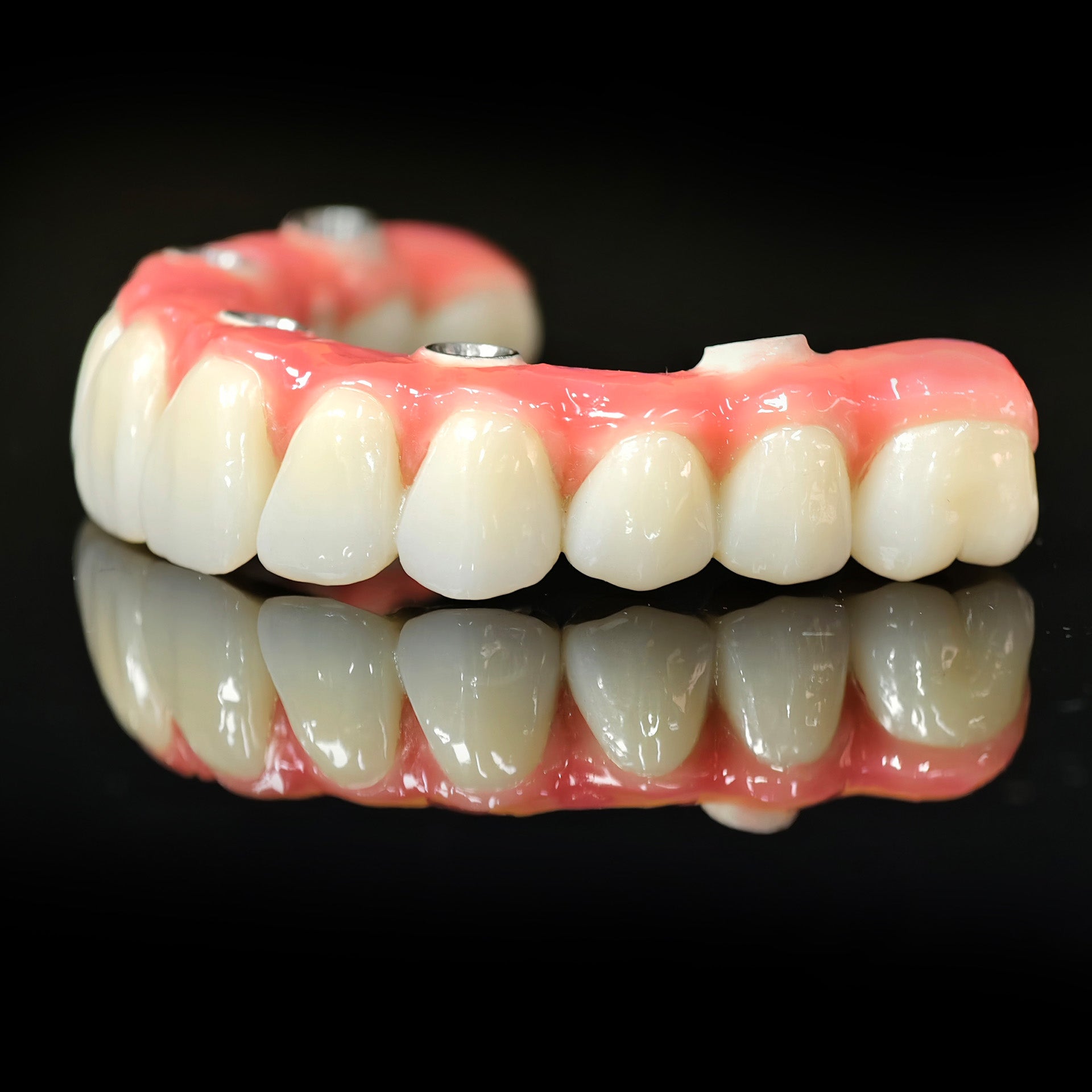 Zirconia-Enamel Hybrid Malo Bridge