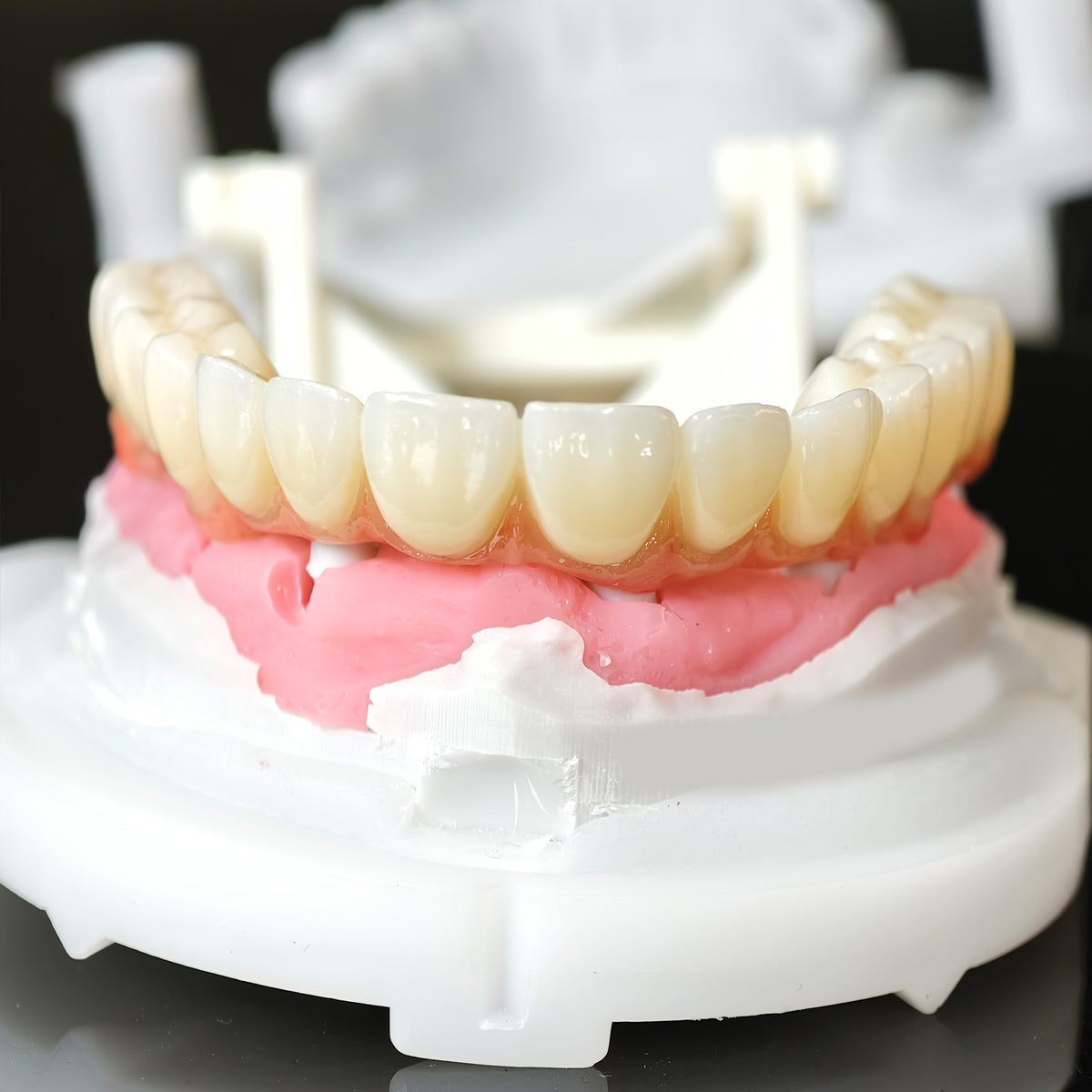 Zirconia Bridge With Cement Retained