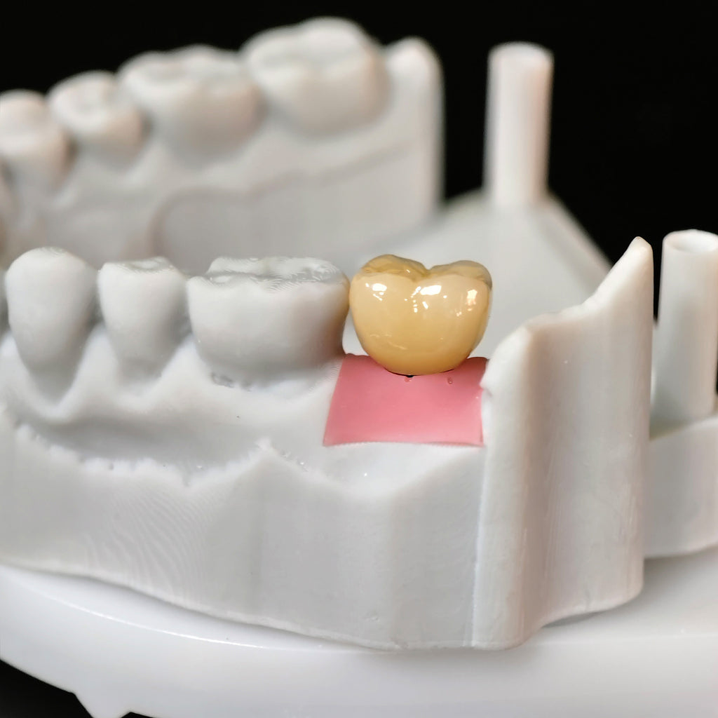 Zirconia Crowns With Screw Retained