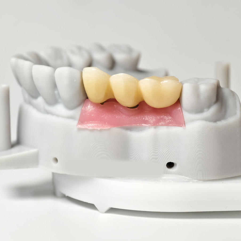 Zirconia Implant Bridge Screwmentable Dental Crown