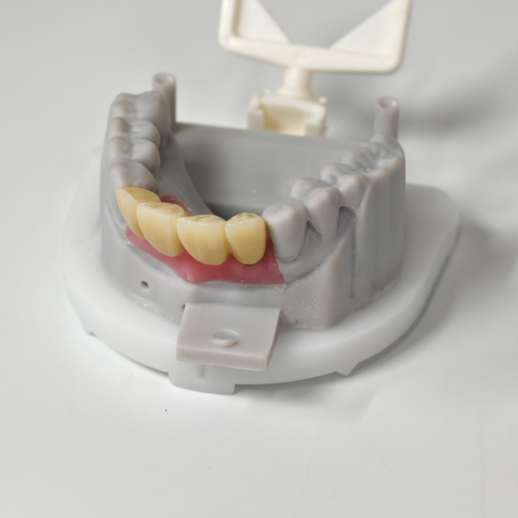 Zirconia Implant Bridge Screwmentable Dental Crown