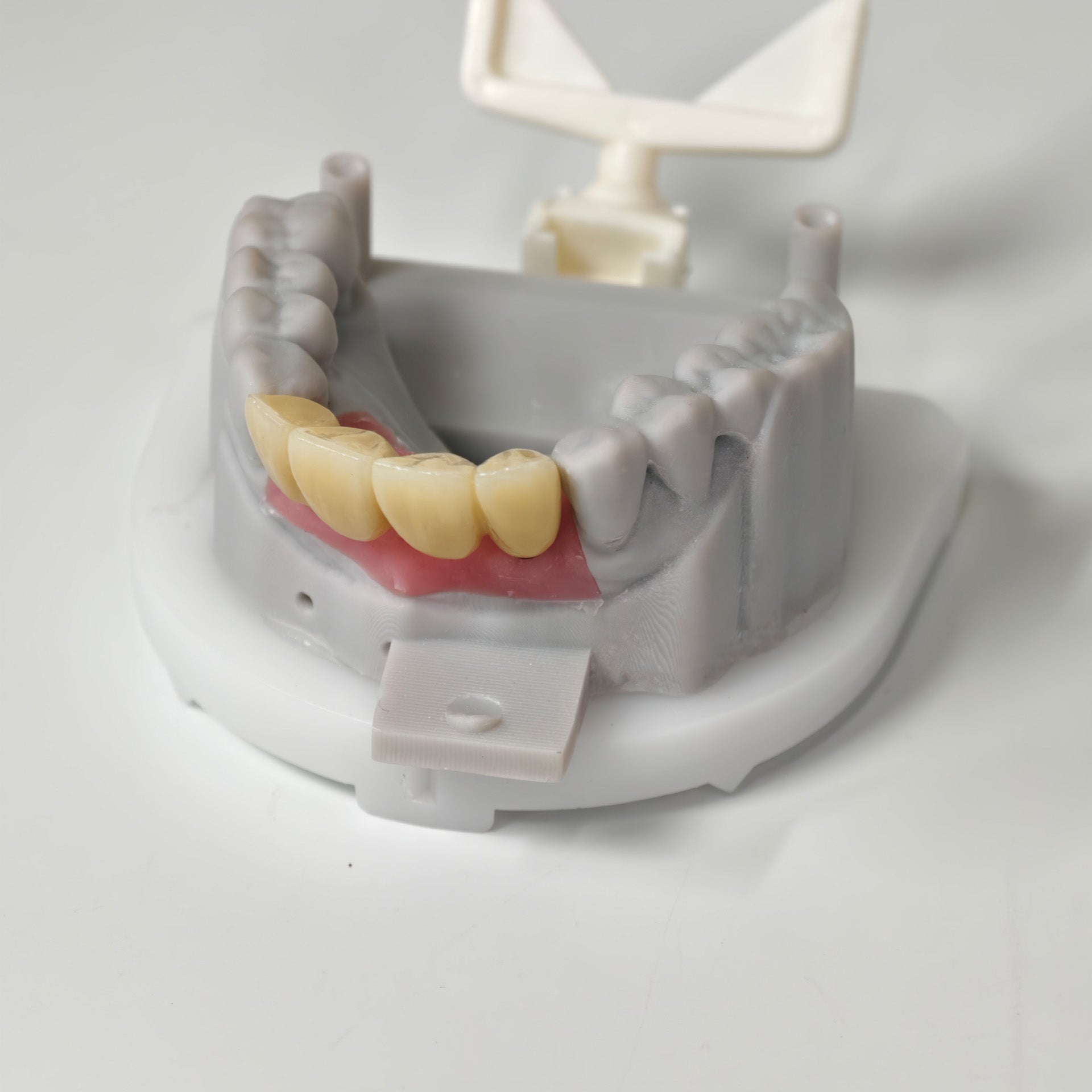 Zirconia Implant Bridge Screwmentable Dental Crown