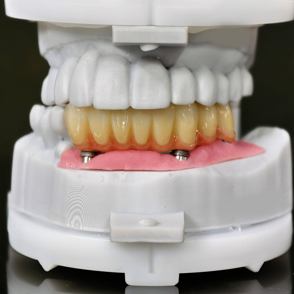 Zirconia Implant Bridge Screwmentable Dental Crown