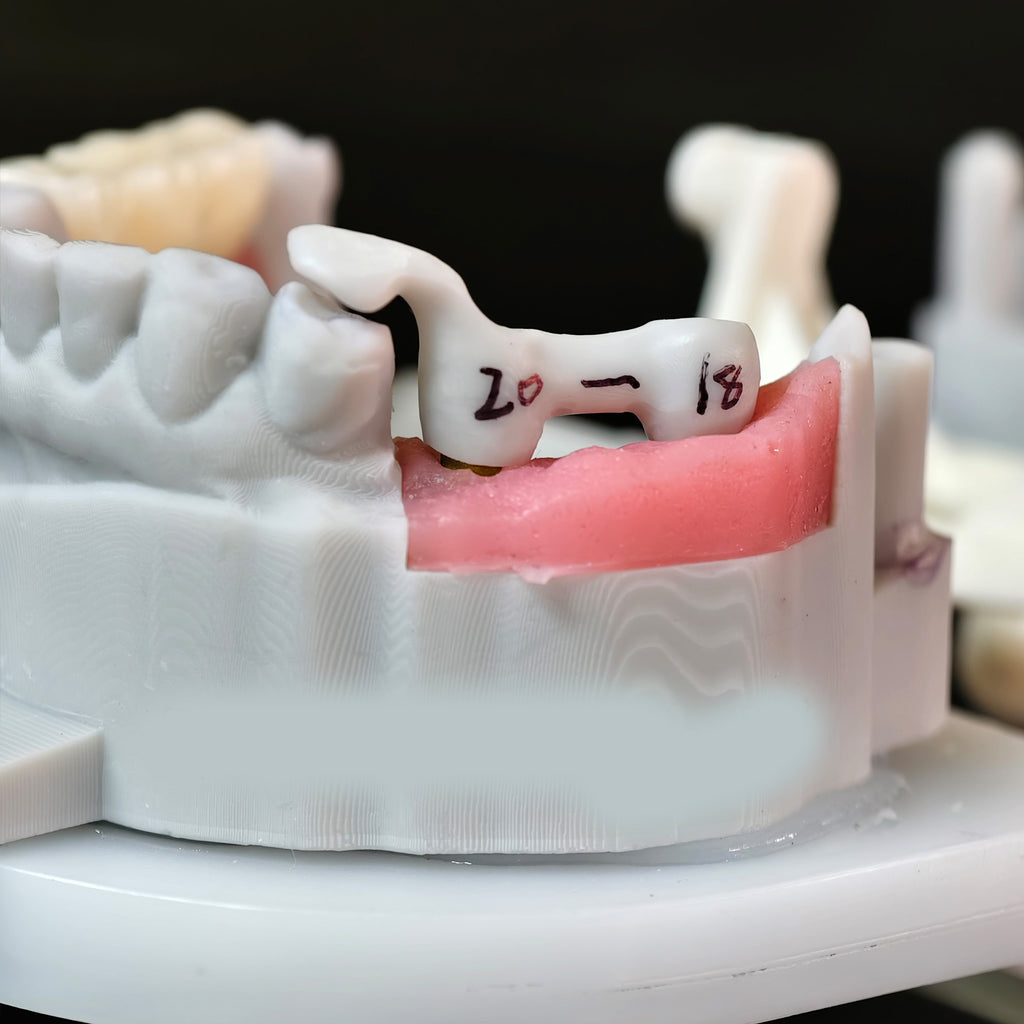 Zirconia Implant Bridge Screwmentable Dental Crown