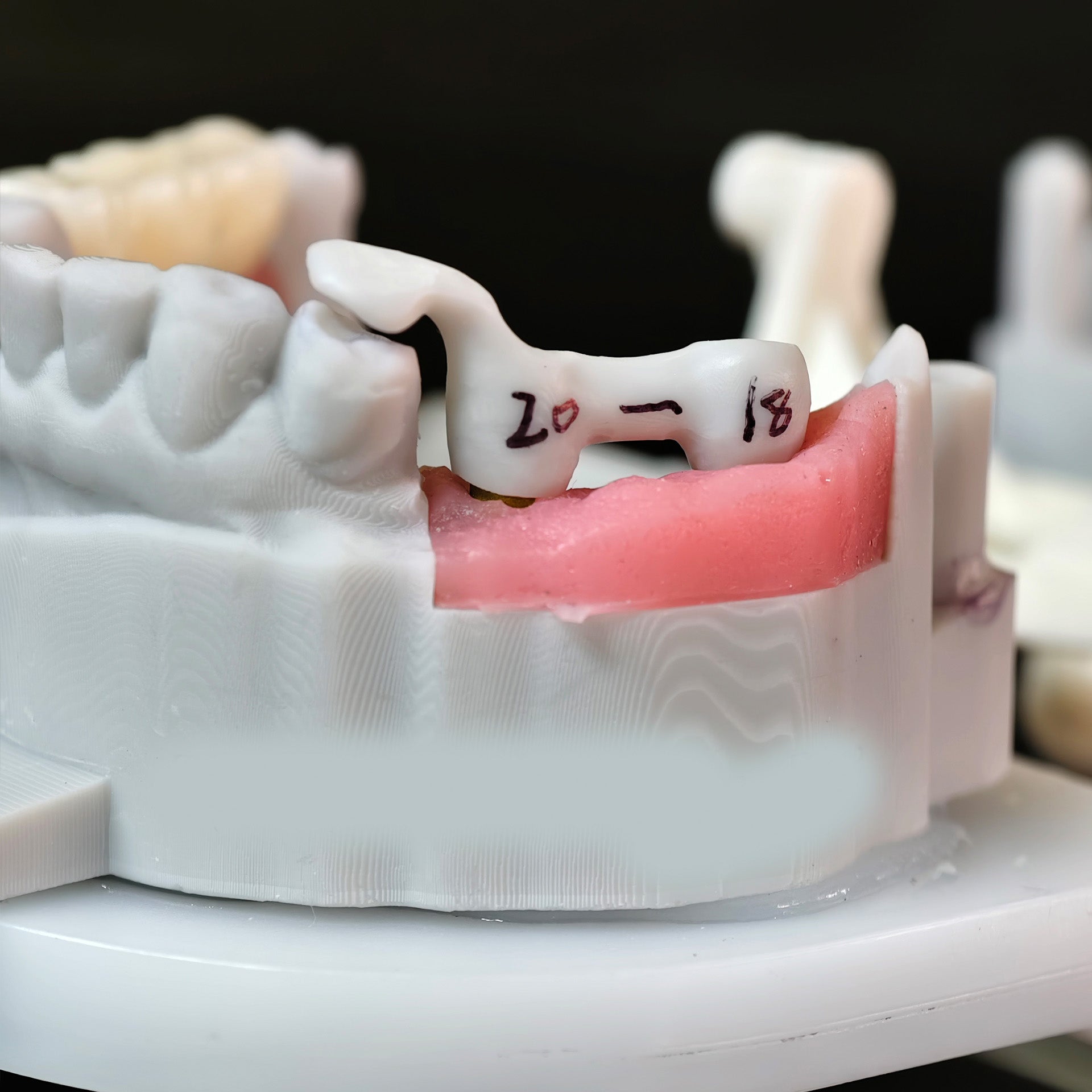 Zirconia Implant Bridge Screwmentable Dental Crown