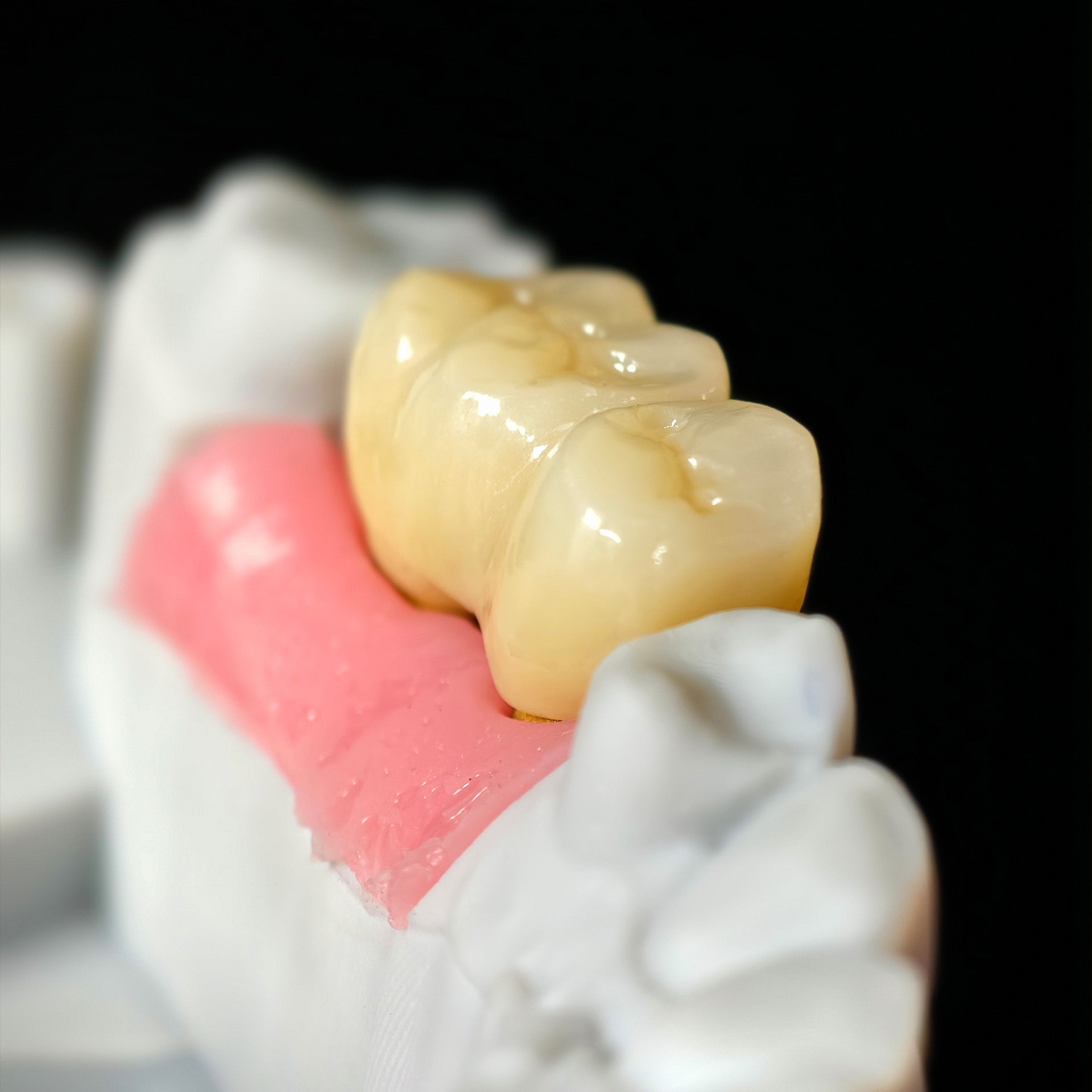 Zirconia Implant Bridge Screwmentable Dental Crown