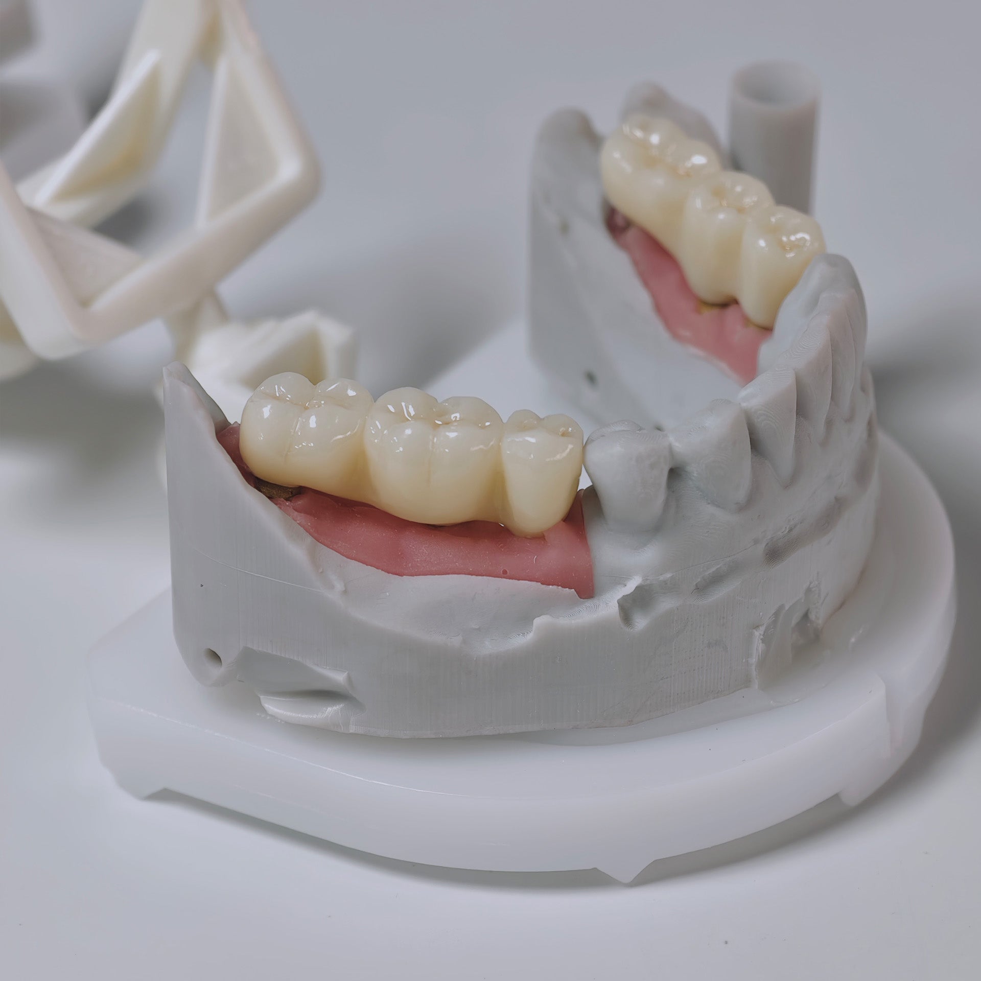 Zirconia Implant Bridges Screwmentable Dental Crown