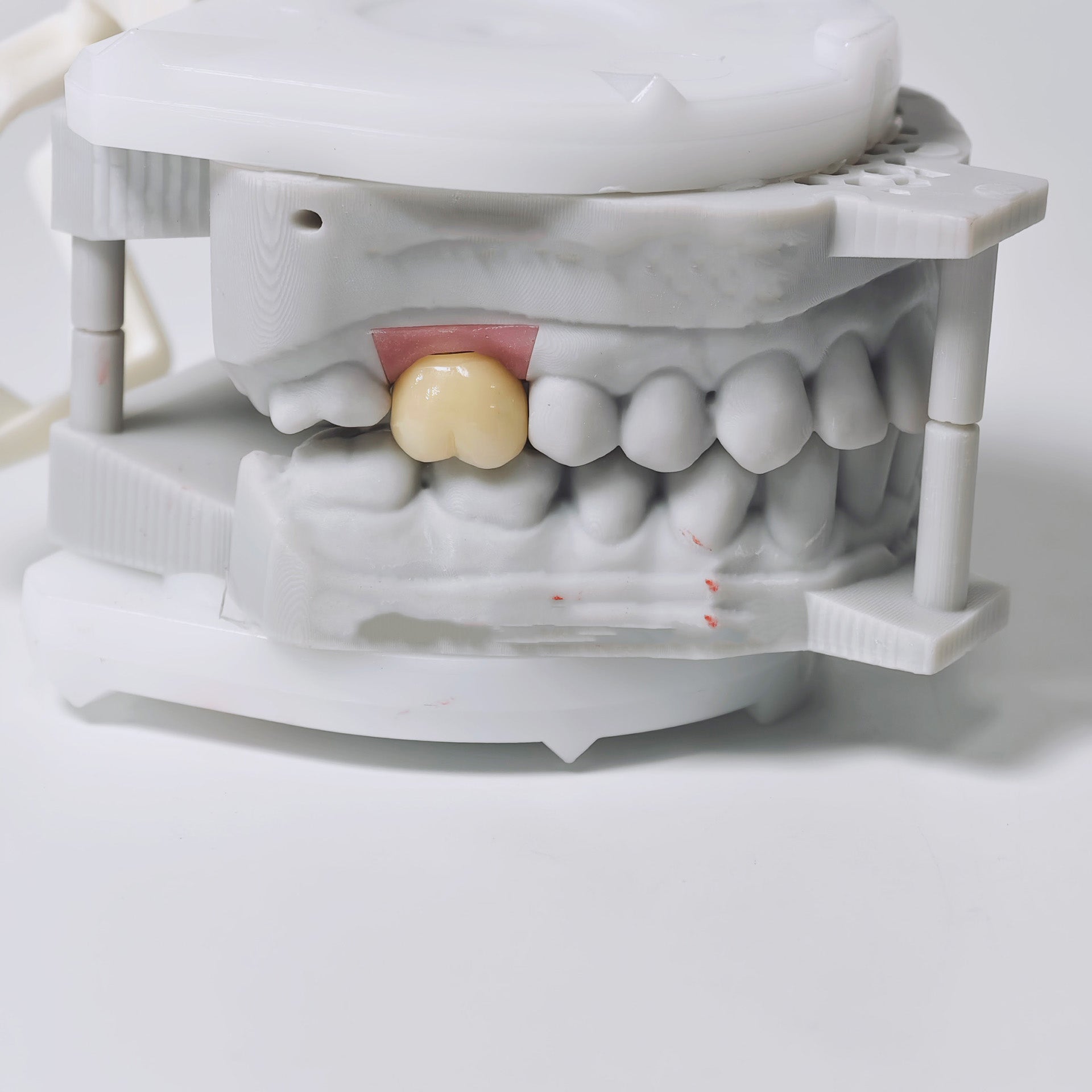 Zirconia Implant Crown Screwmentable Dental Crown