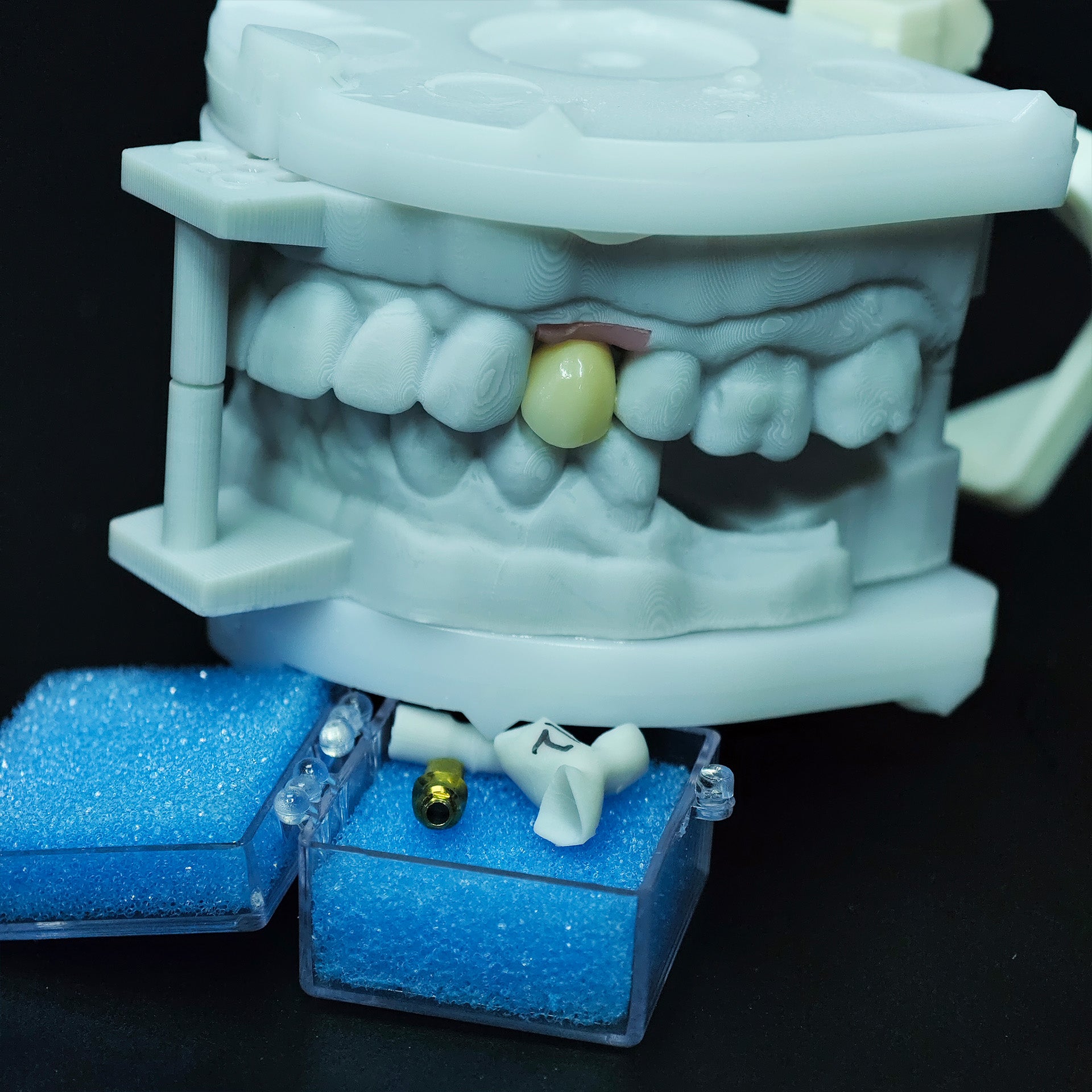 Zirconia Implant Crown Screwmentable Dental Crown