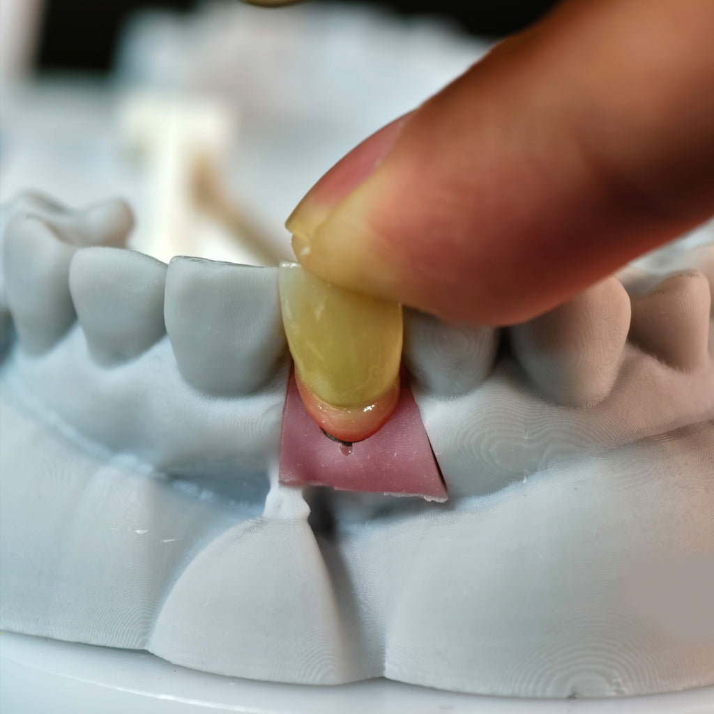 Zirconia Implant Crown Screwmentable Dental Crown