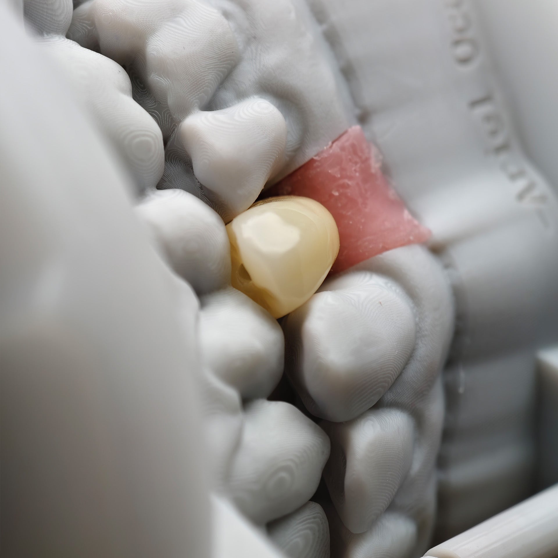 Zirconia Implant Crown Screwmentable Dental Crown