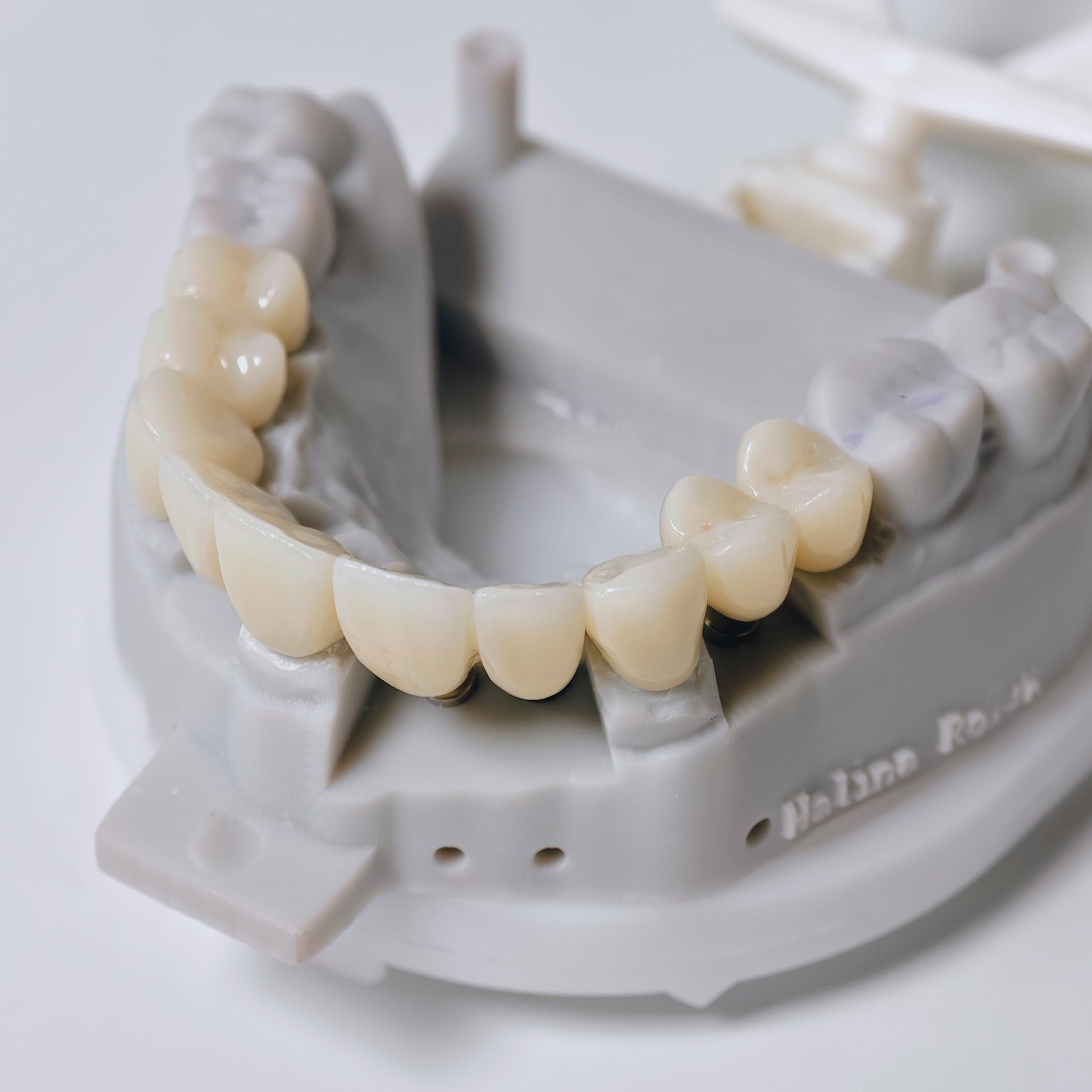 Zirconia Implant Crown And Bridge Screwmentable Dental Crown