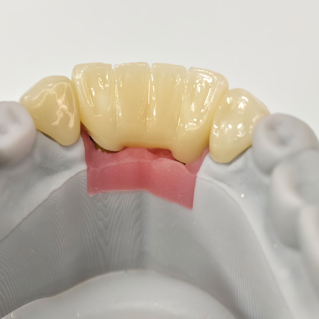 Zirconia Implant Crown And Bridge Screwmentable Dental Crown