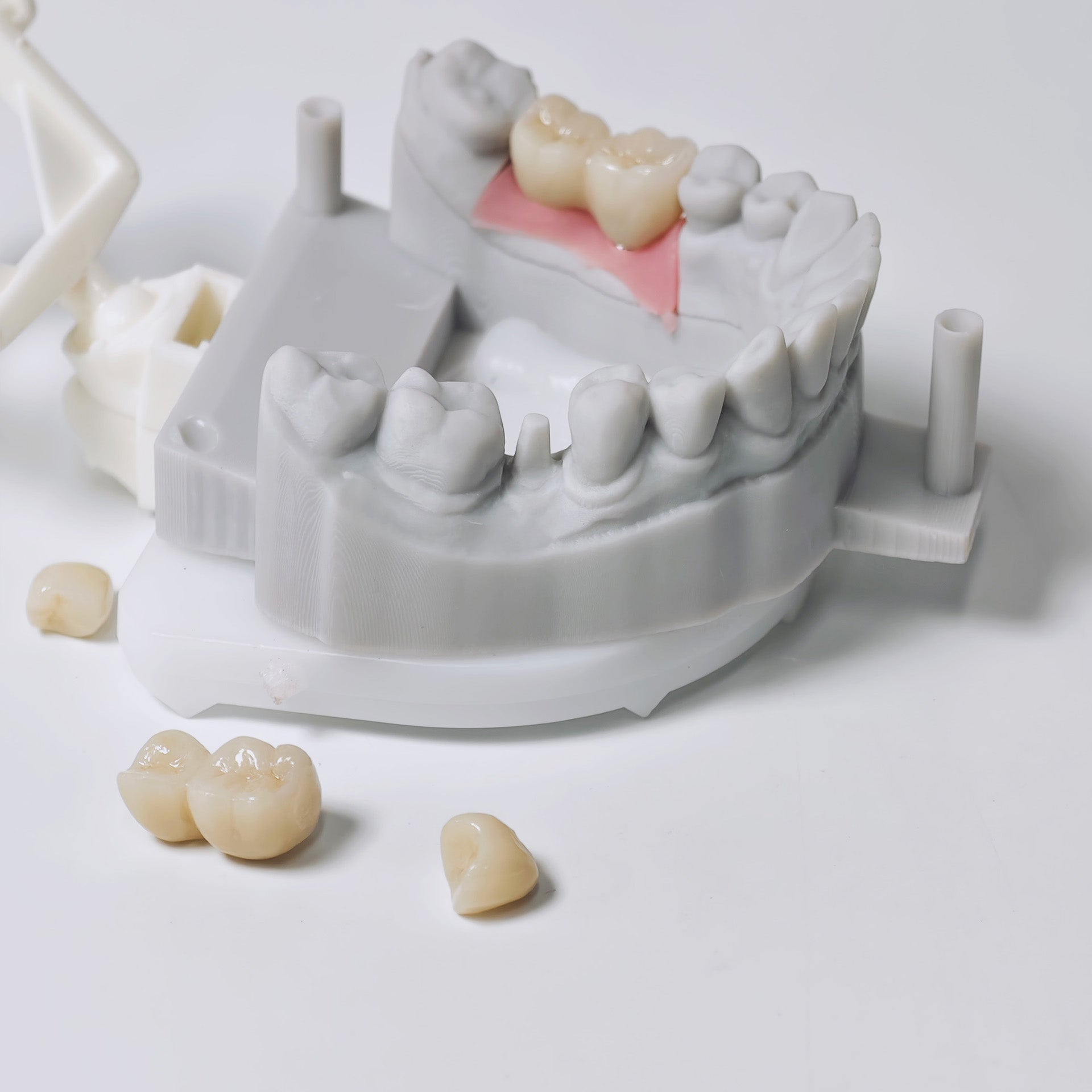 Zirconia Implant Crowns And Bridges Screwmentable Dental Crown