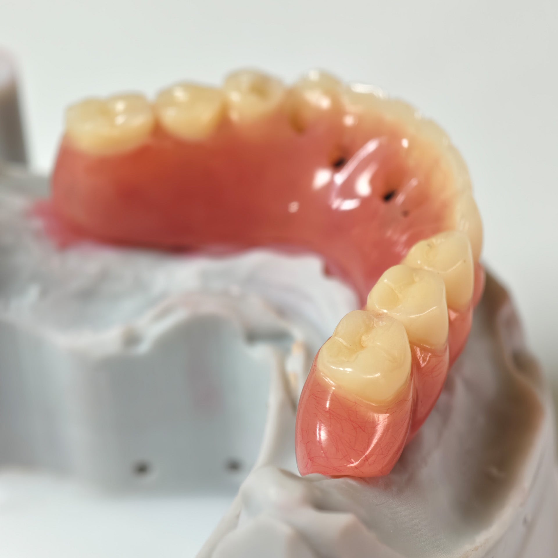Acrylic Denture With Ti-Bar And Screw Retained