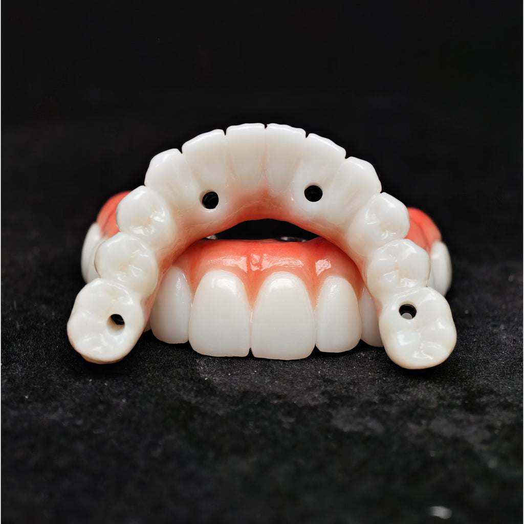 All On 4 Zirconia Bridge With Ti-Base Screw Retained Trying For Full Arch Restoration