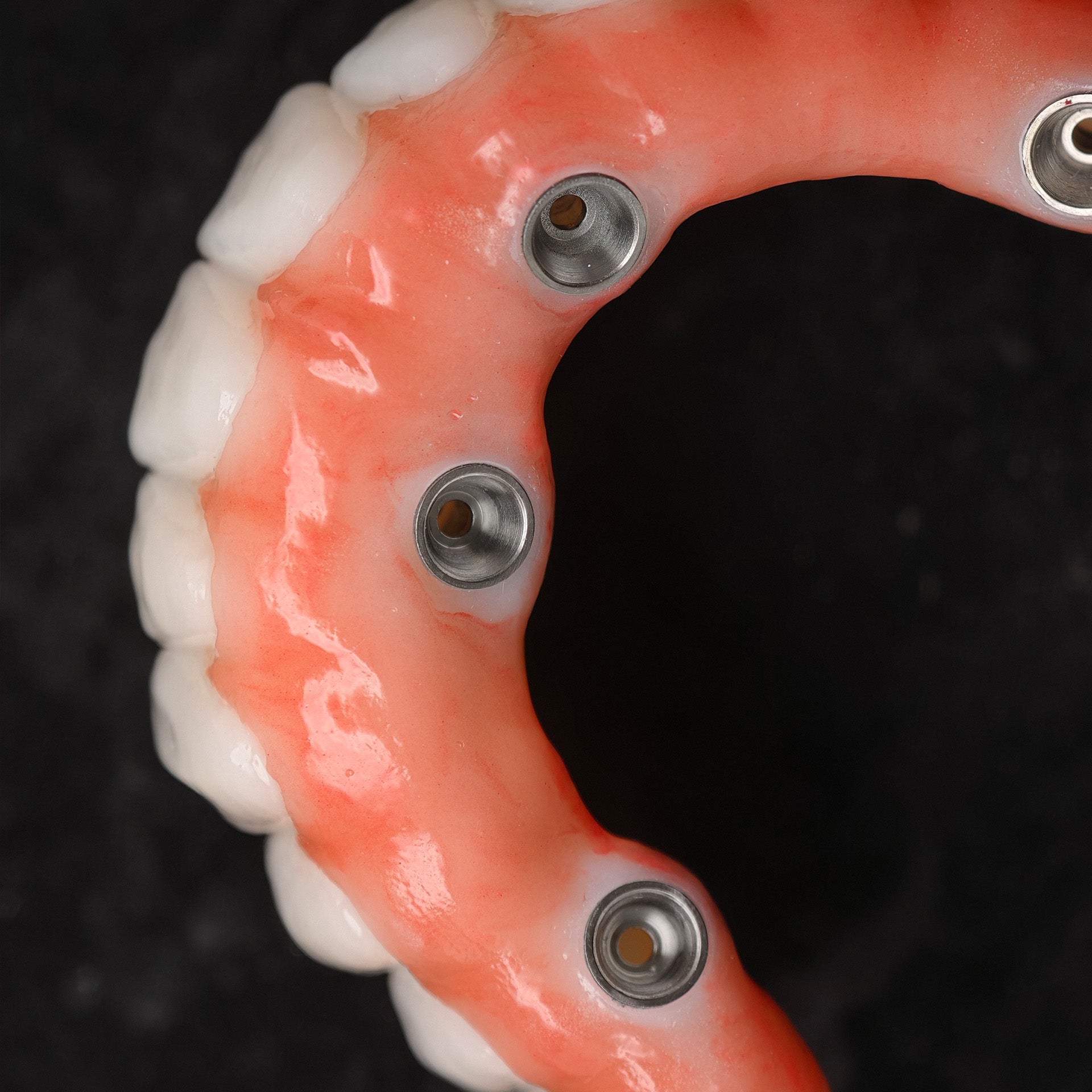 All On 4 Zirconia Bridge With Ti-Base Screw Retained Trying For Full Arch Restoration