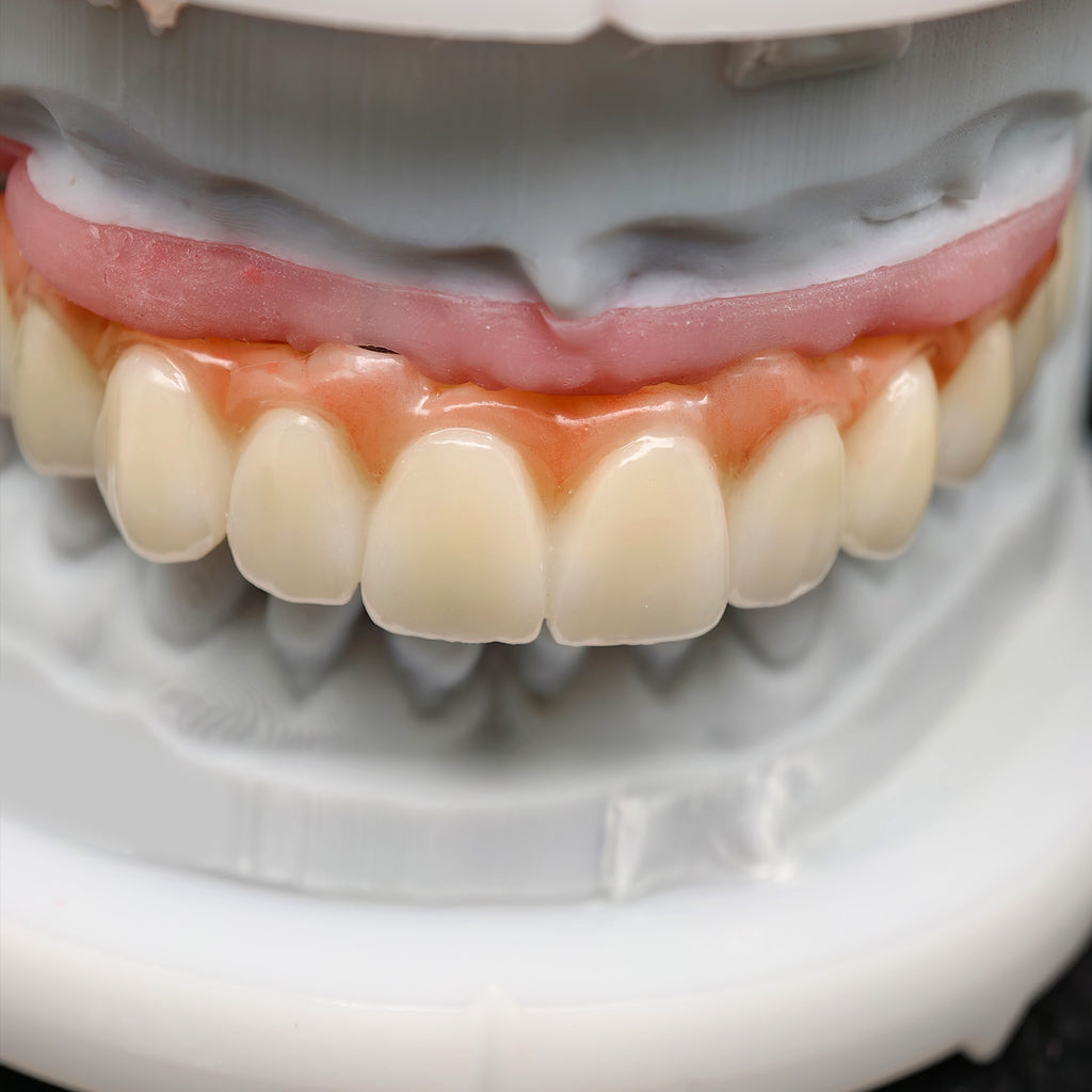 All On 4 Zirconia Bridge With Ti-Base Screw Retained Trying For Full Arch Restoration