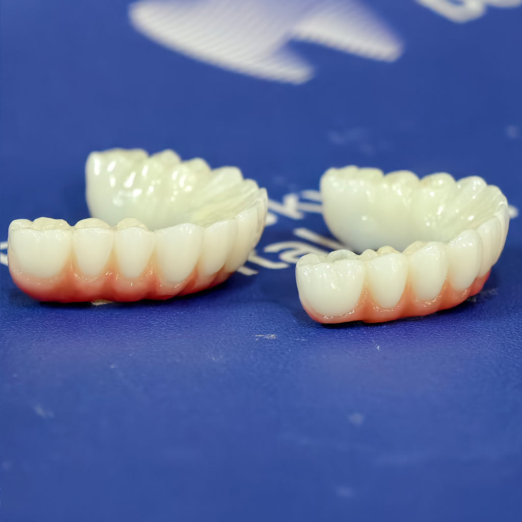 All On 4 Zirconia Bridge With Ti-Base Screw Retained Trying For Full Arch Restoration