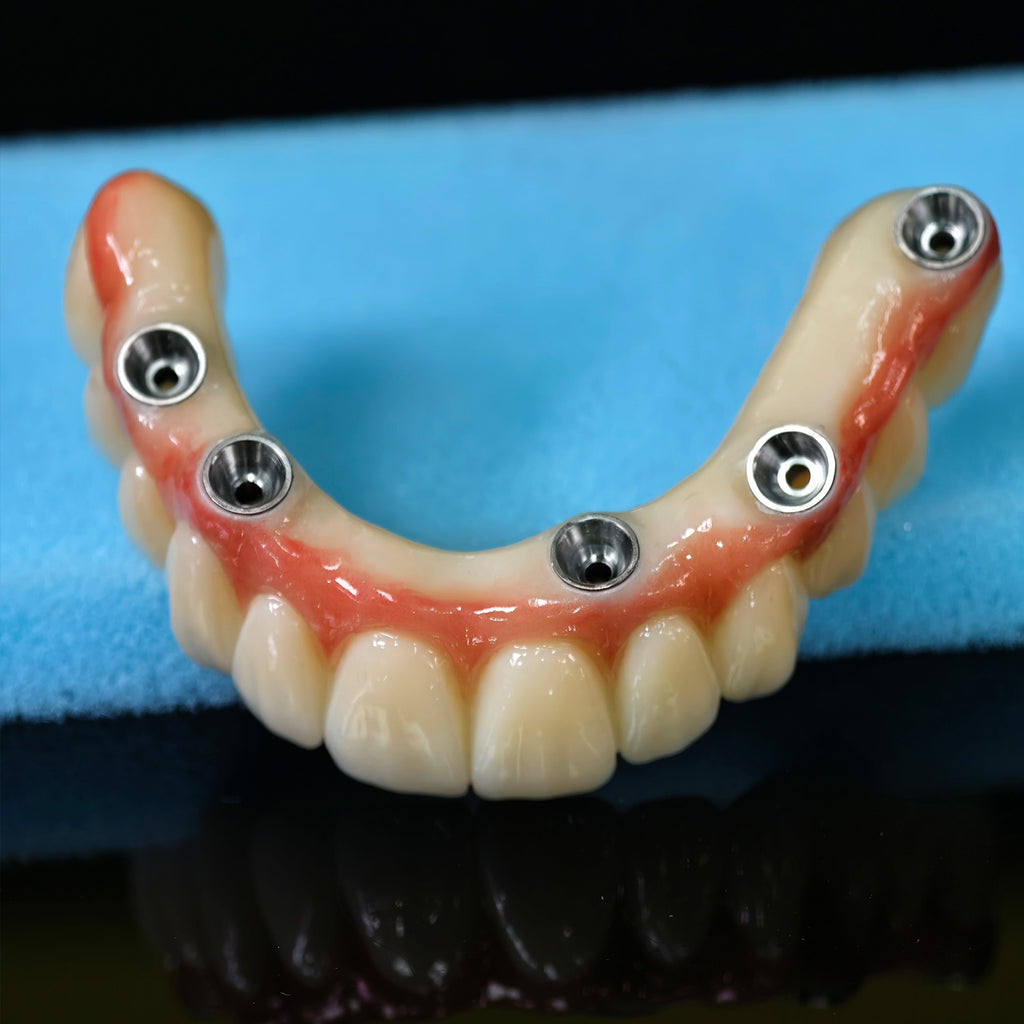 All On 5 Zirconia Bridge With Ti-Base Screw Retained Trying For Full Arch Restoration