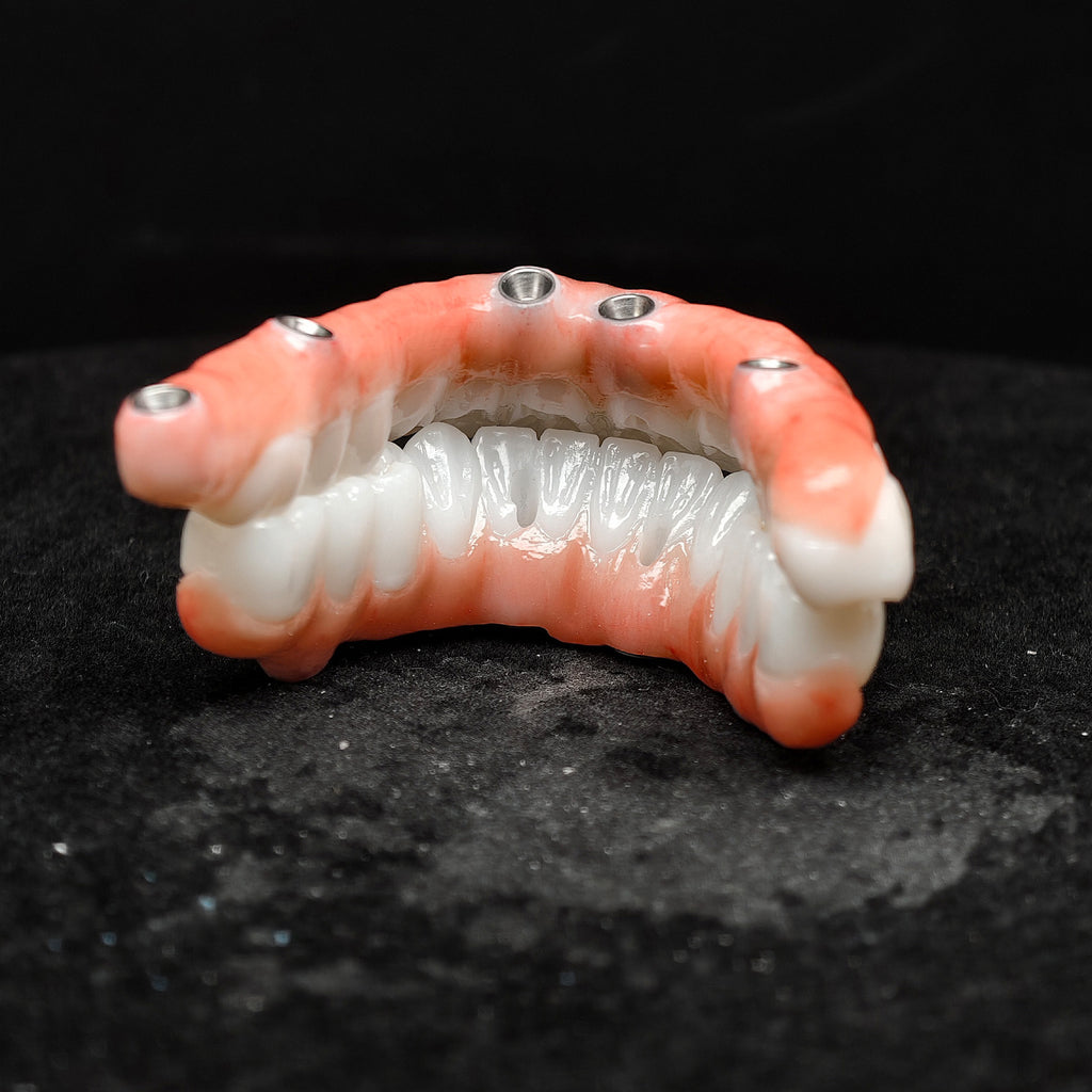 All On 5 Zirconia Bridge With Ti-Base Screw Retained Trying For Full Arch Restoration