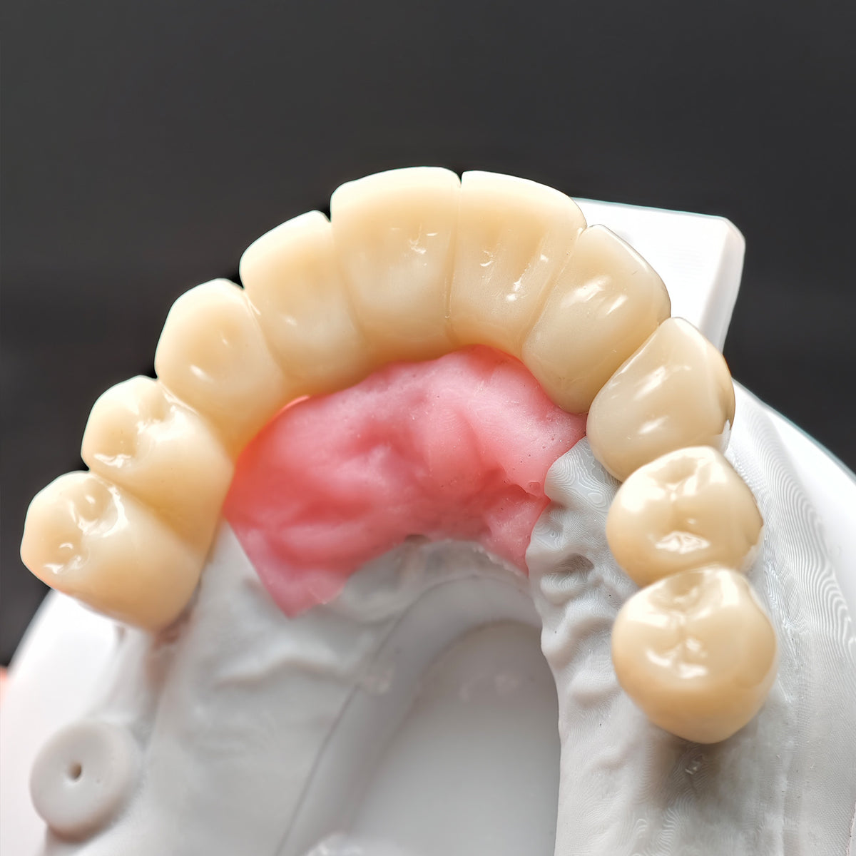 Custom Abutment With Zirconia Crown And Bridge