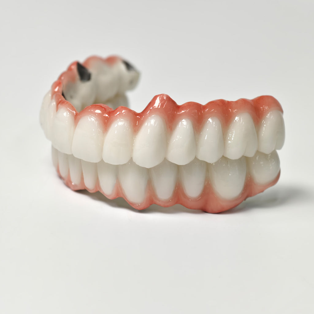 Full-Arch PFM Bridge With Screw Retained