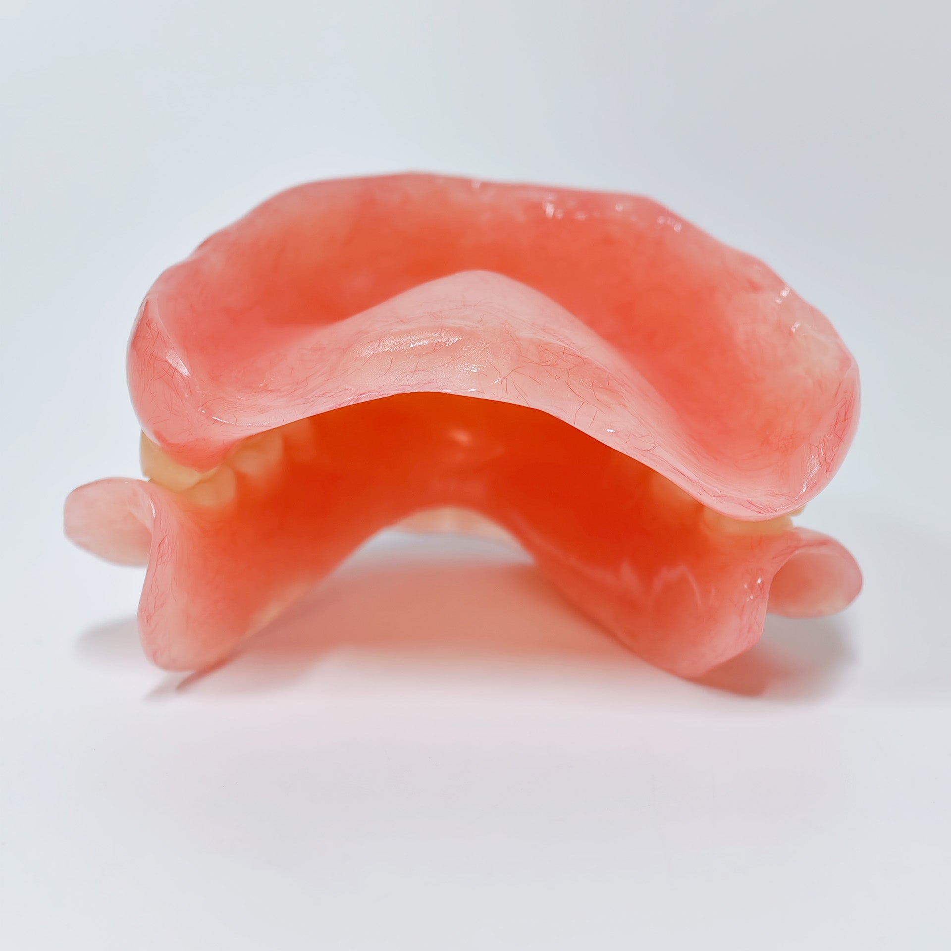 Full-Mouth Acrylic Denture