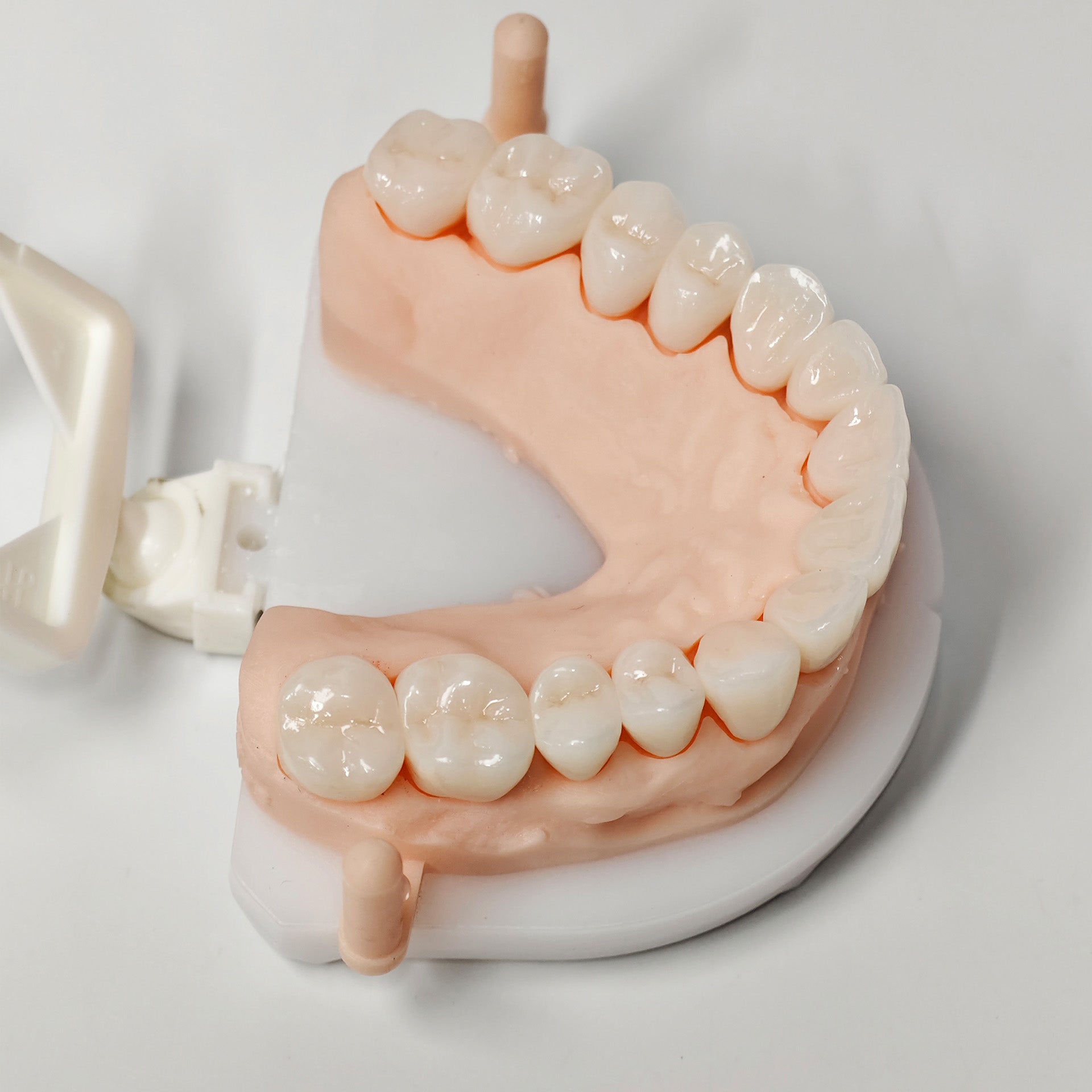 Full-Zriconia Crowns With Cement-Retained