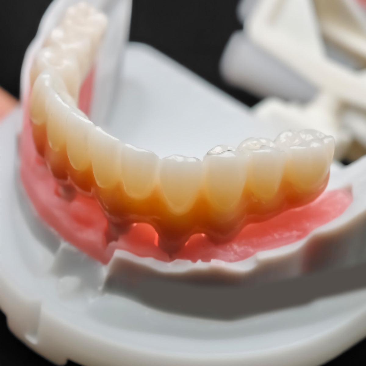 Pmma Bridge And Zirconia Bridge With Cemented