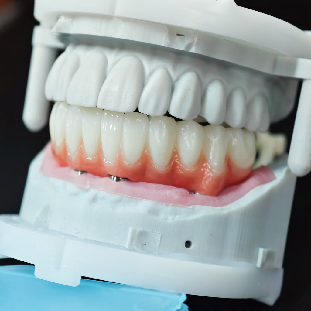 Zirconia Bridge With Ti-Base Abutment