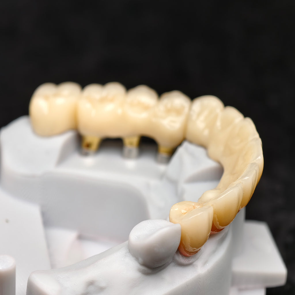 Zirconia Crown And Birdge With Cemented And Implant Seating Guide