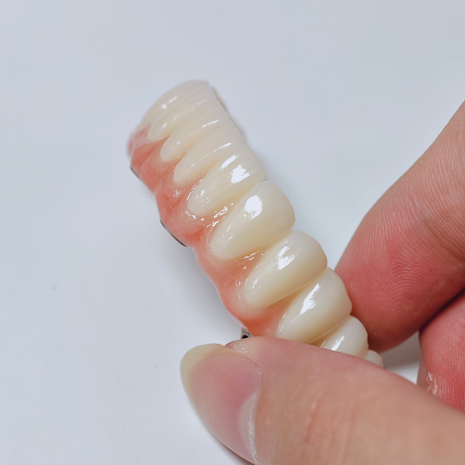 All On 4 Zirconia Bridge With Ti-Base Screw Retained