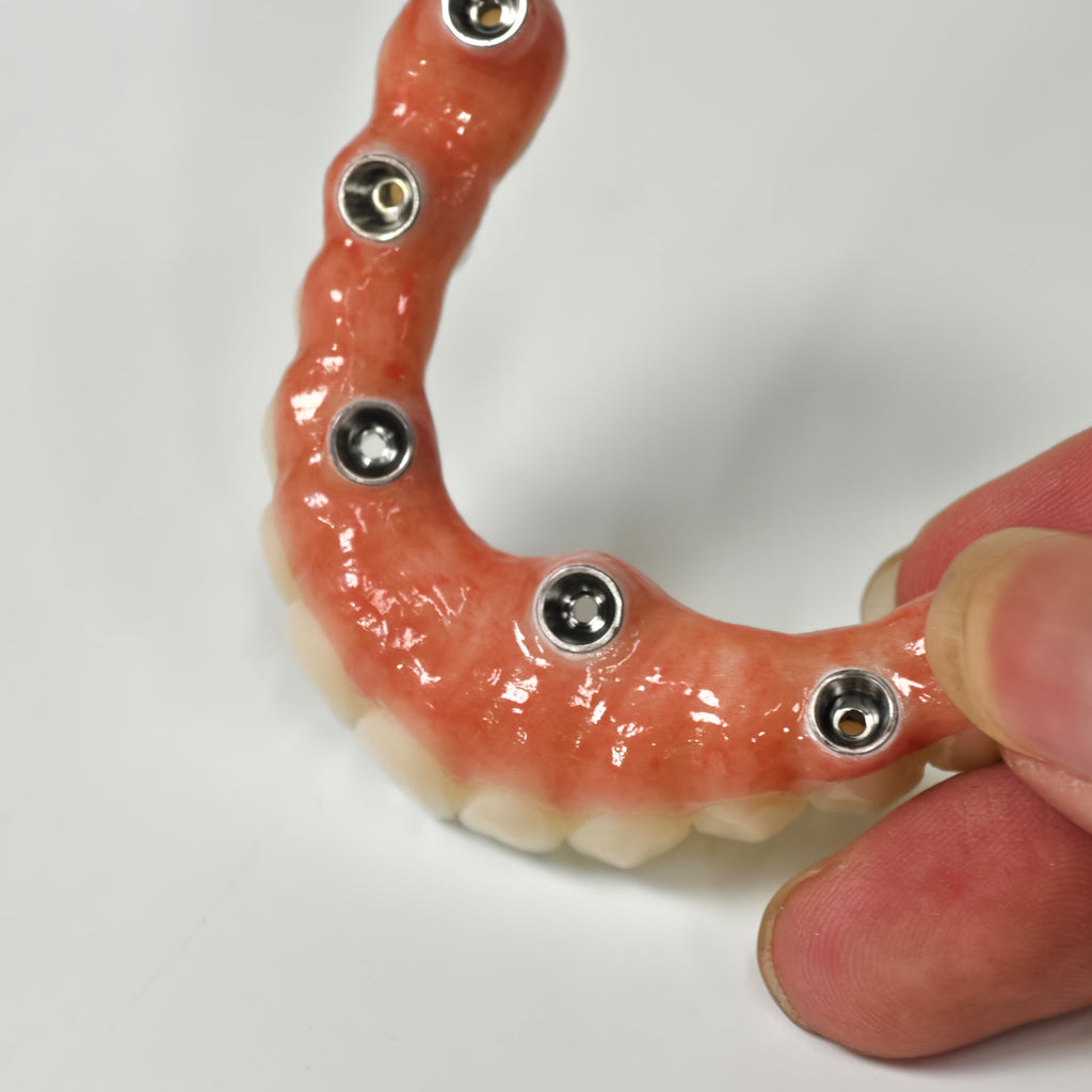 All On 5 Zirconia Bridge With Ti-Base Screw Retained