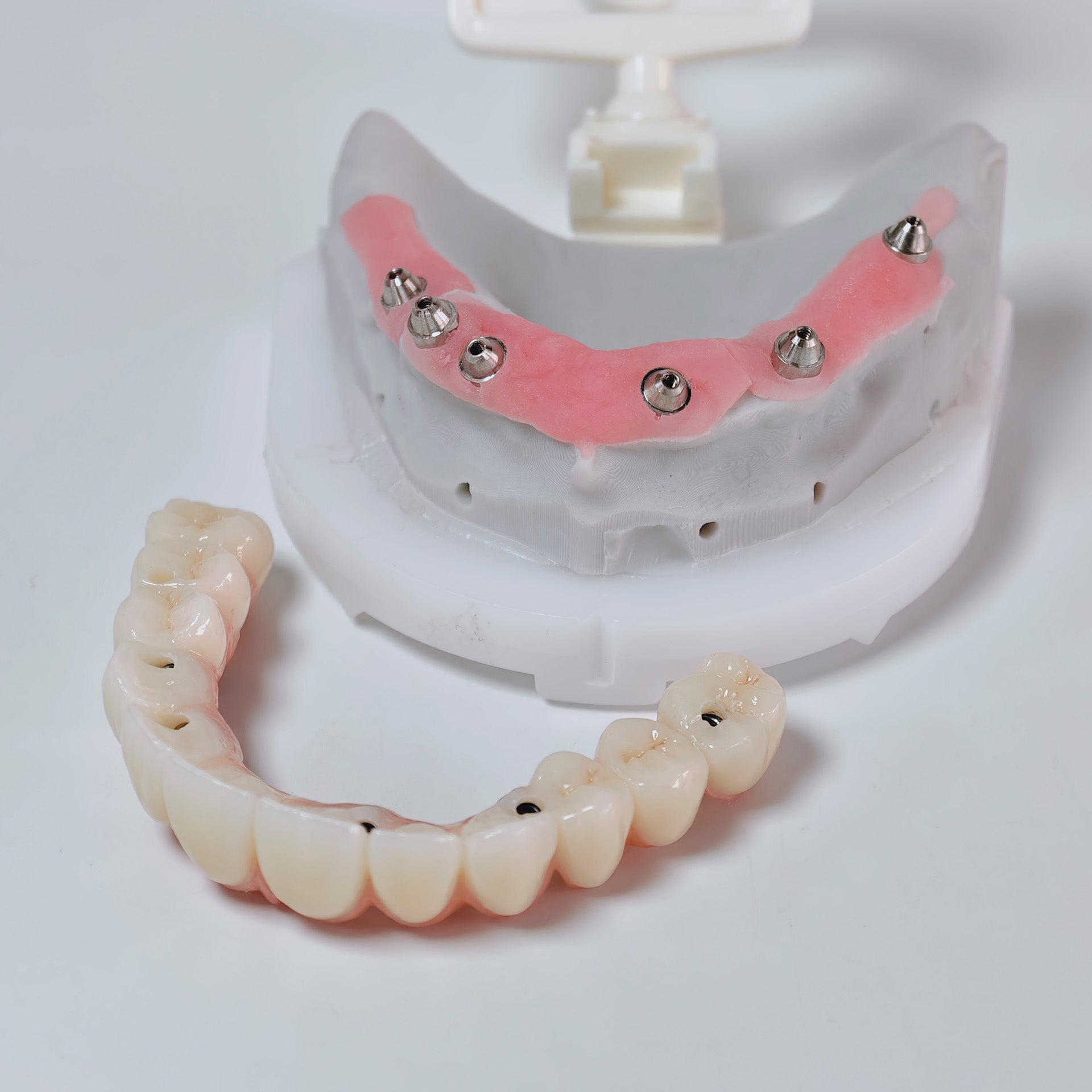 All On 6 Zirconia Bridge With Ti-Base Screw Retained