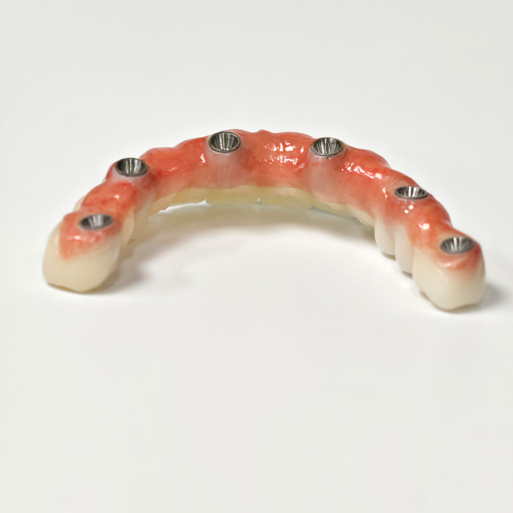 All On 6 Zirconia Bridge With Ti-Base Screw Retained