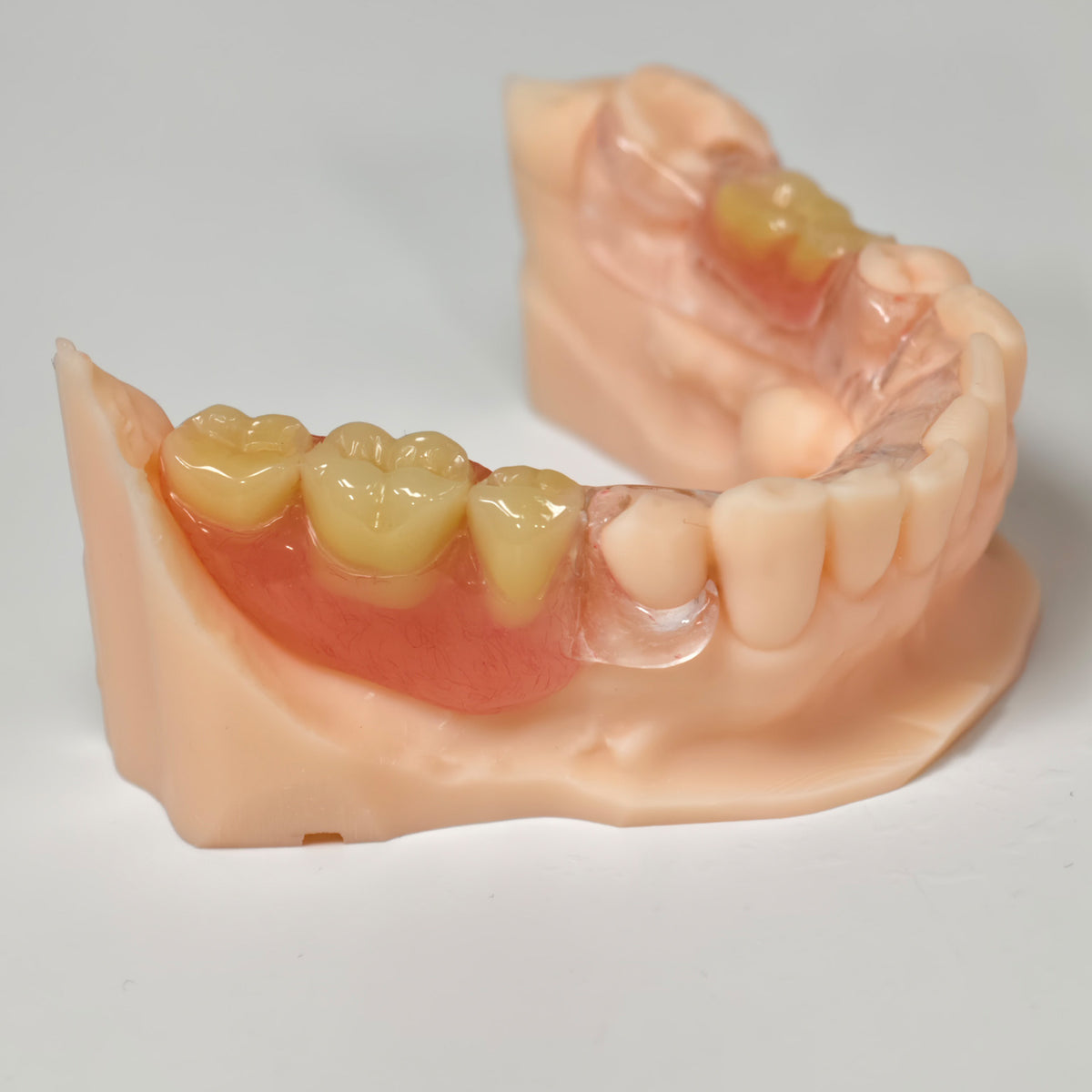 Clear Framework With Acrylic Denture Aesthetic Denture