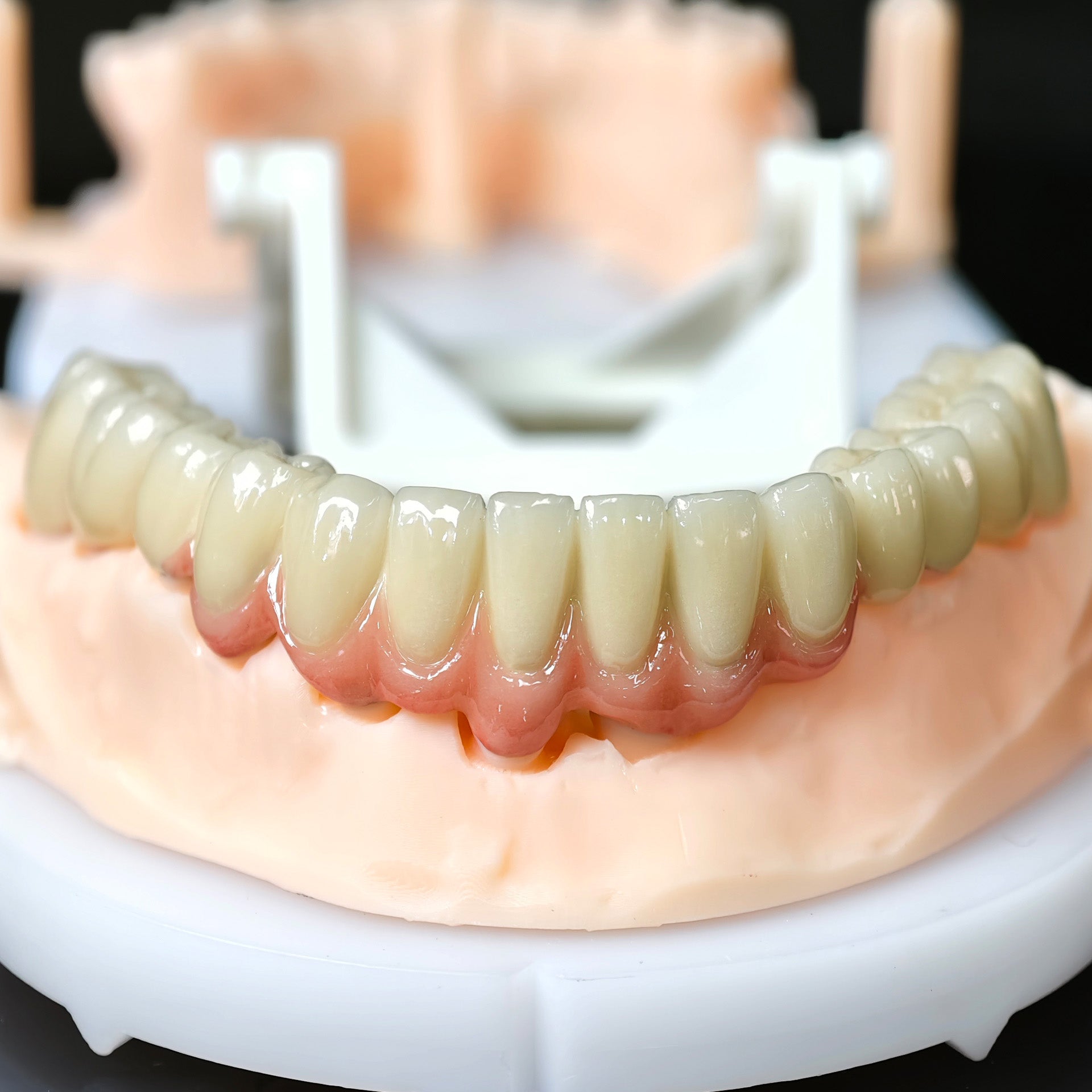 Co - Cr PFM Dental Bridge