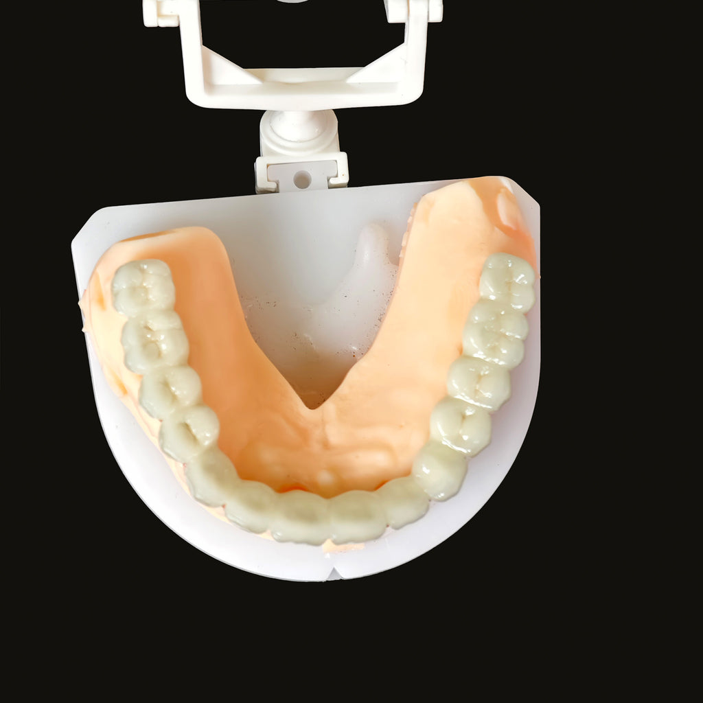 Co - Cr PFM Dental Bridge