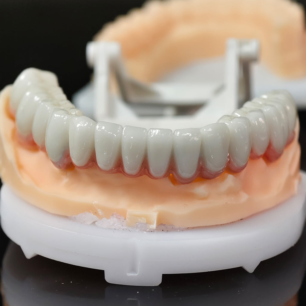 Co - Cr PFM Dental Bridge