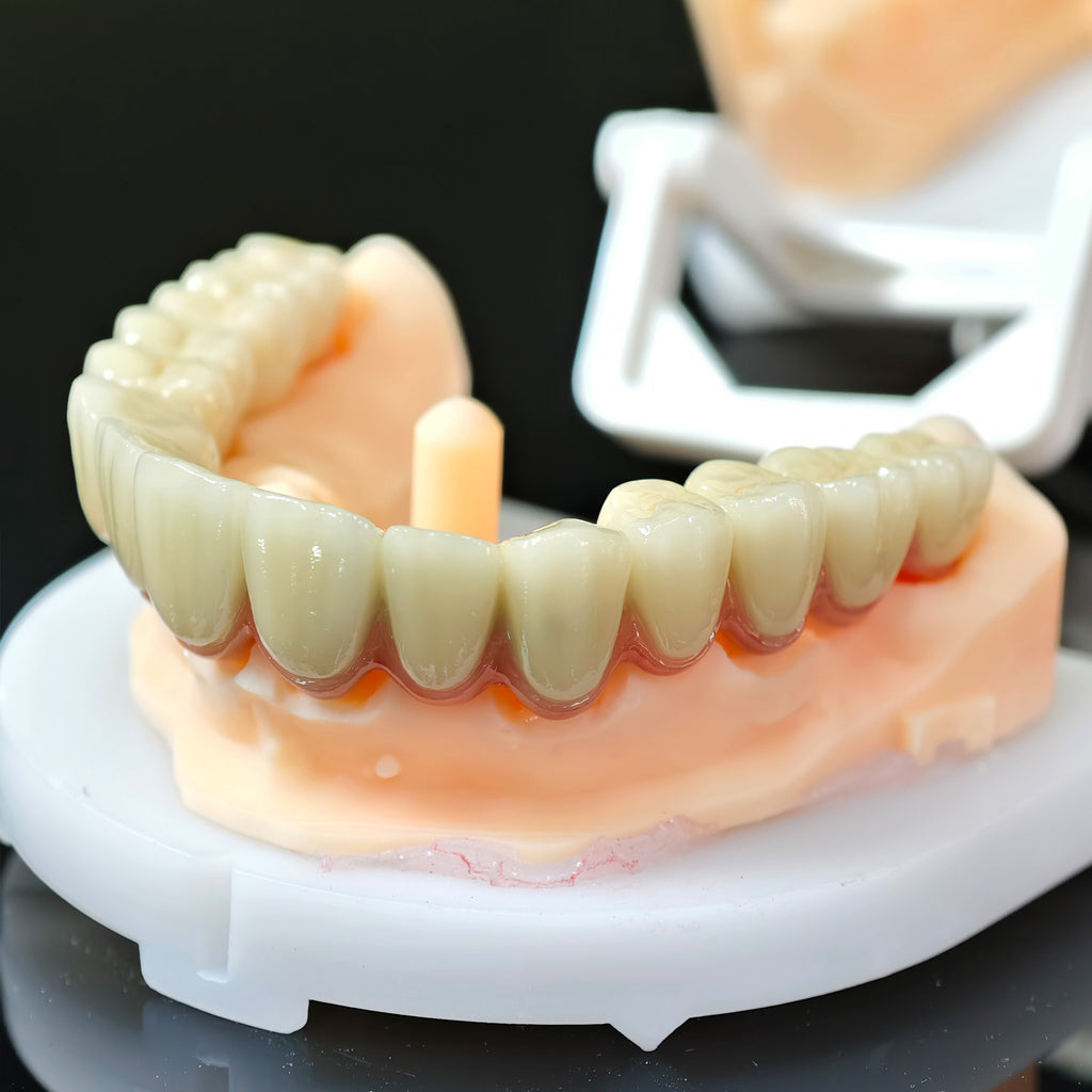 Co - Cr PFM Dental Bridge