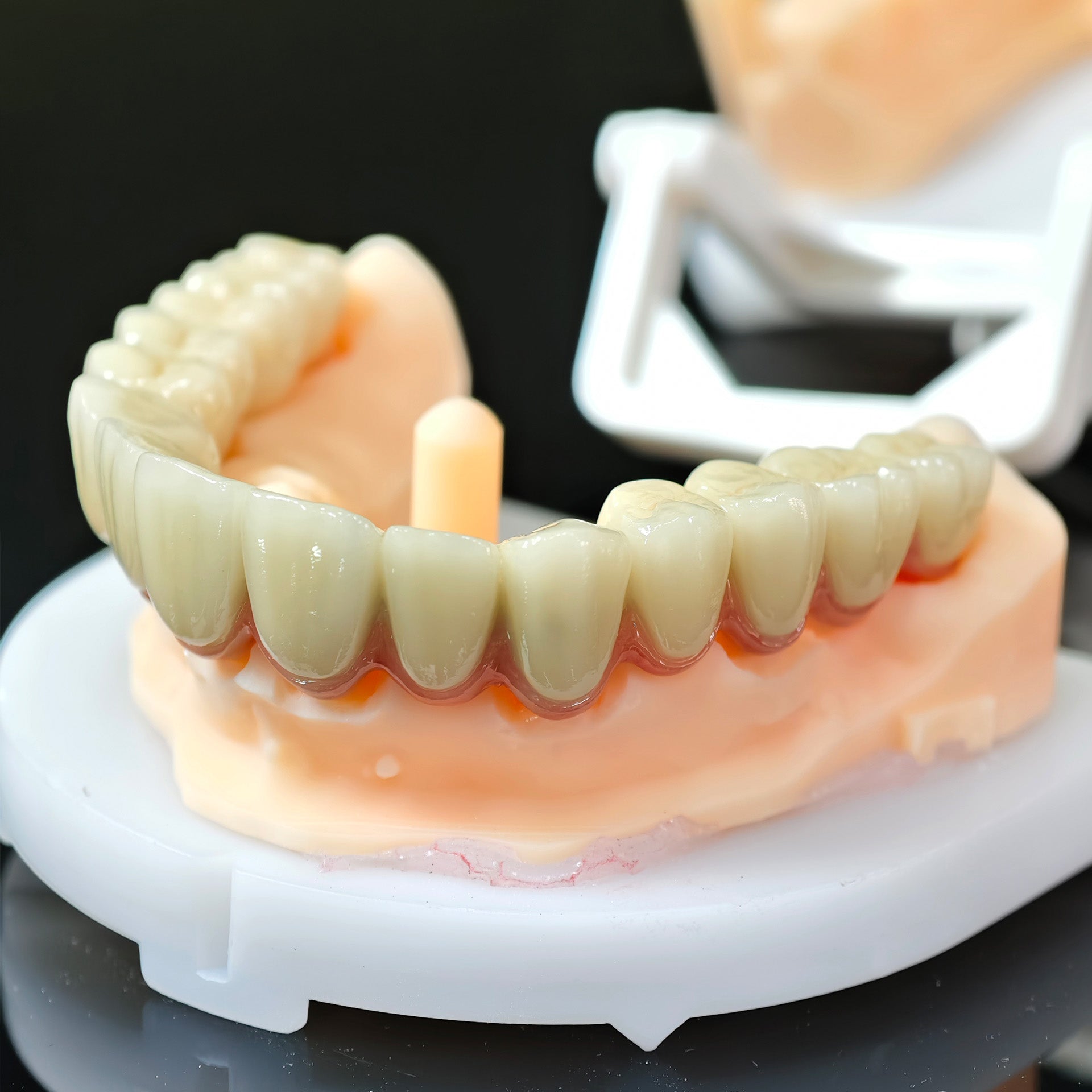 Co - Cr PFM Dental Bridge