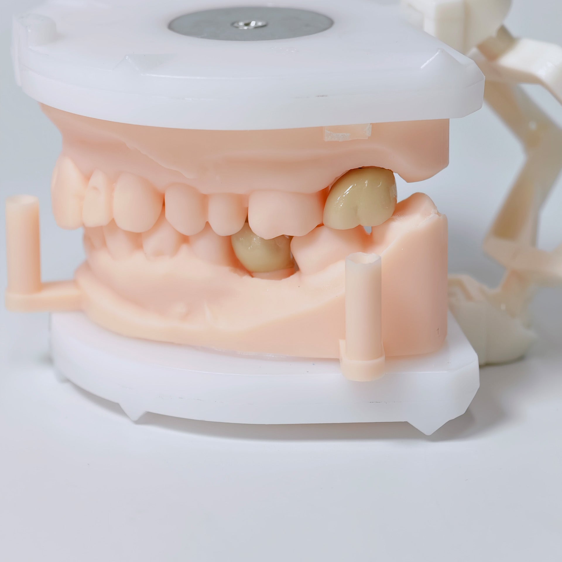 Co - Cr Pfm Dental Crowns And Bridge