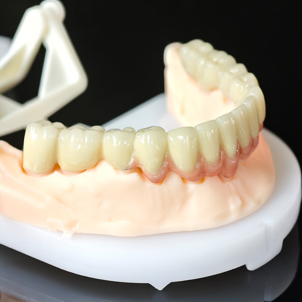Co - Cr PFM Dental Bridge