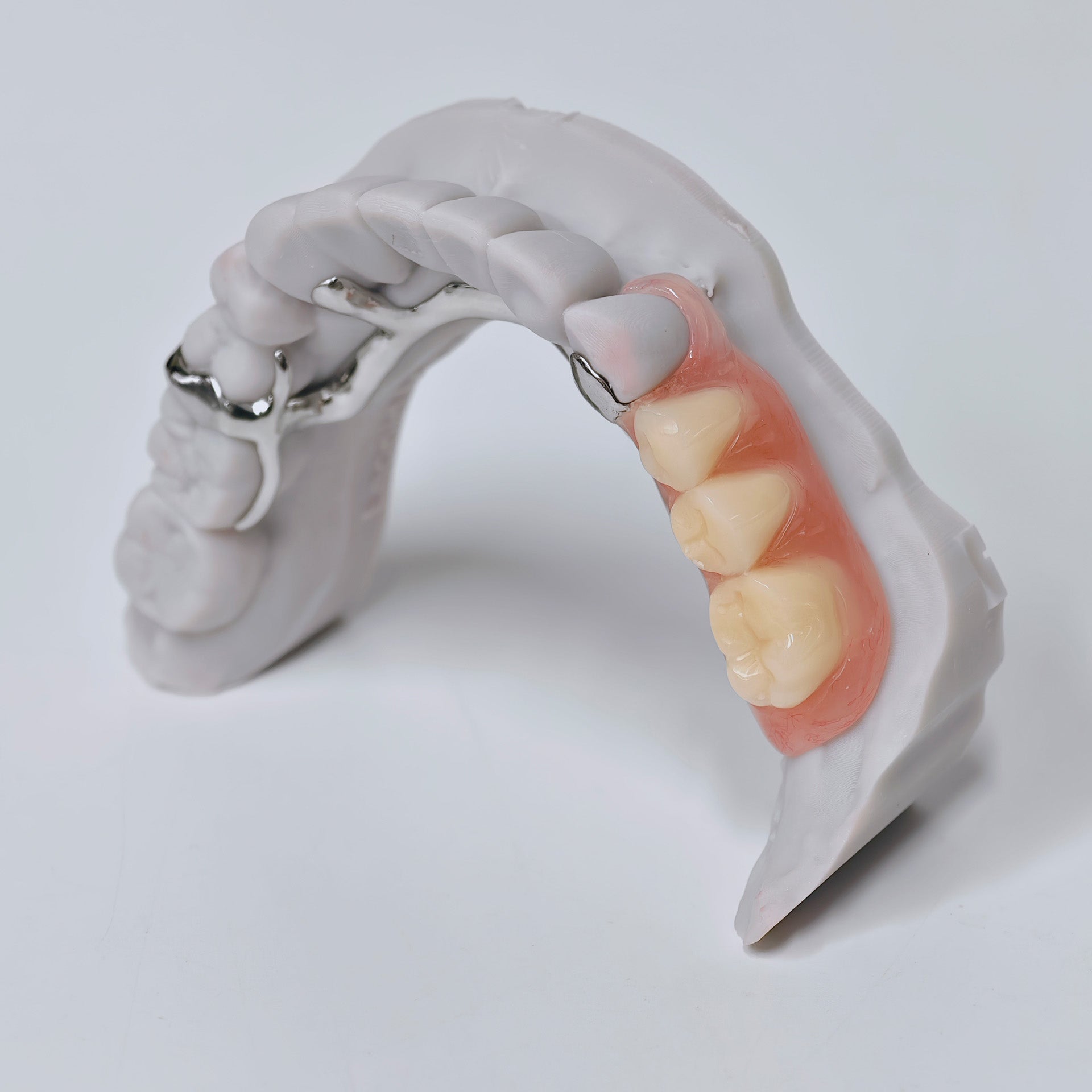 Cobalt Chrome Framework Denture Metal Framework With Acrylic Denture