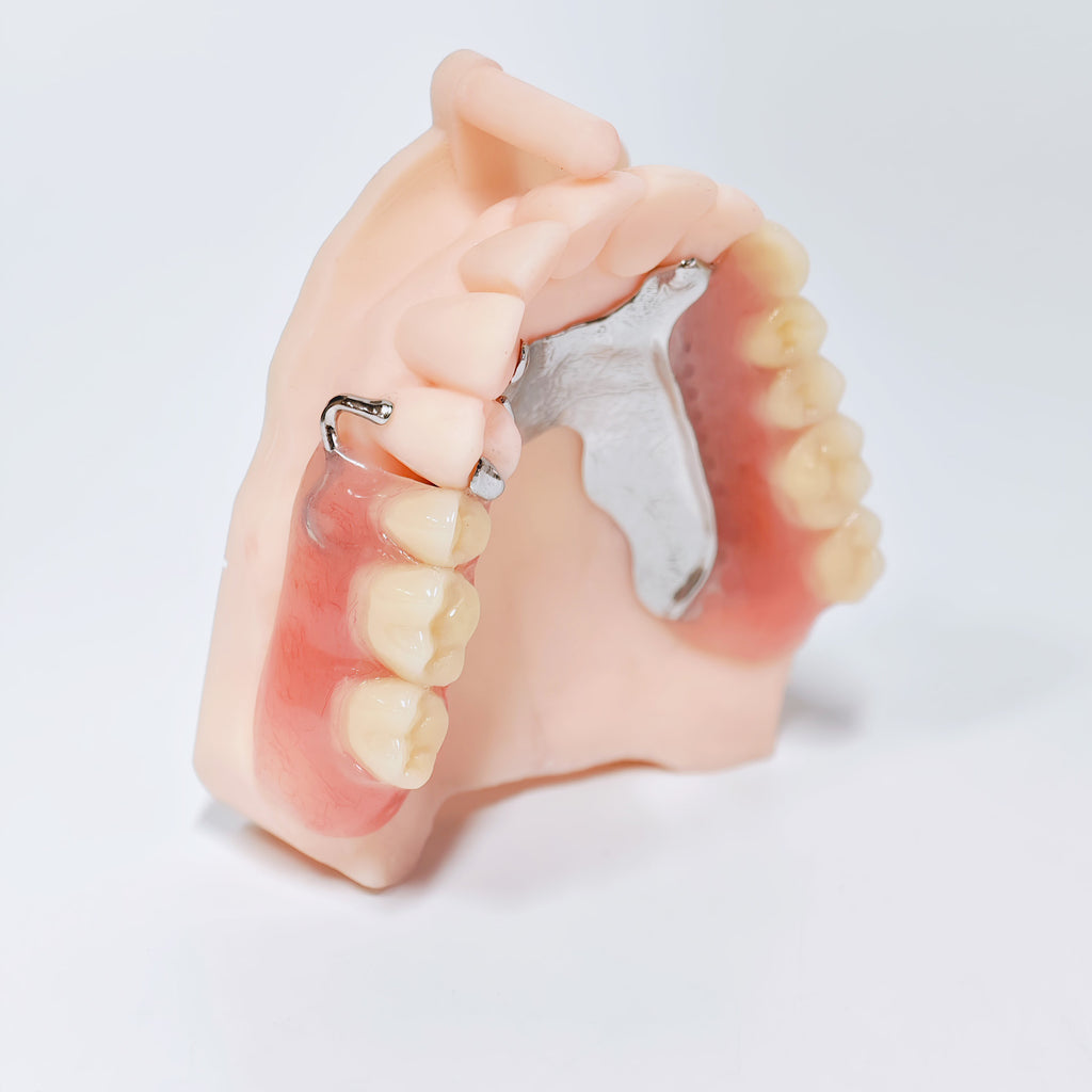 Cobalt Chrome Framework Denture Metal Framework With Acrylic Denture