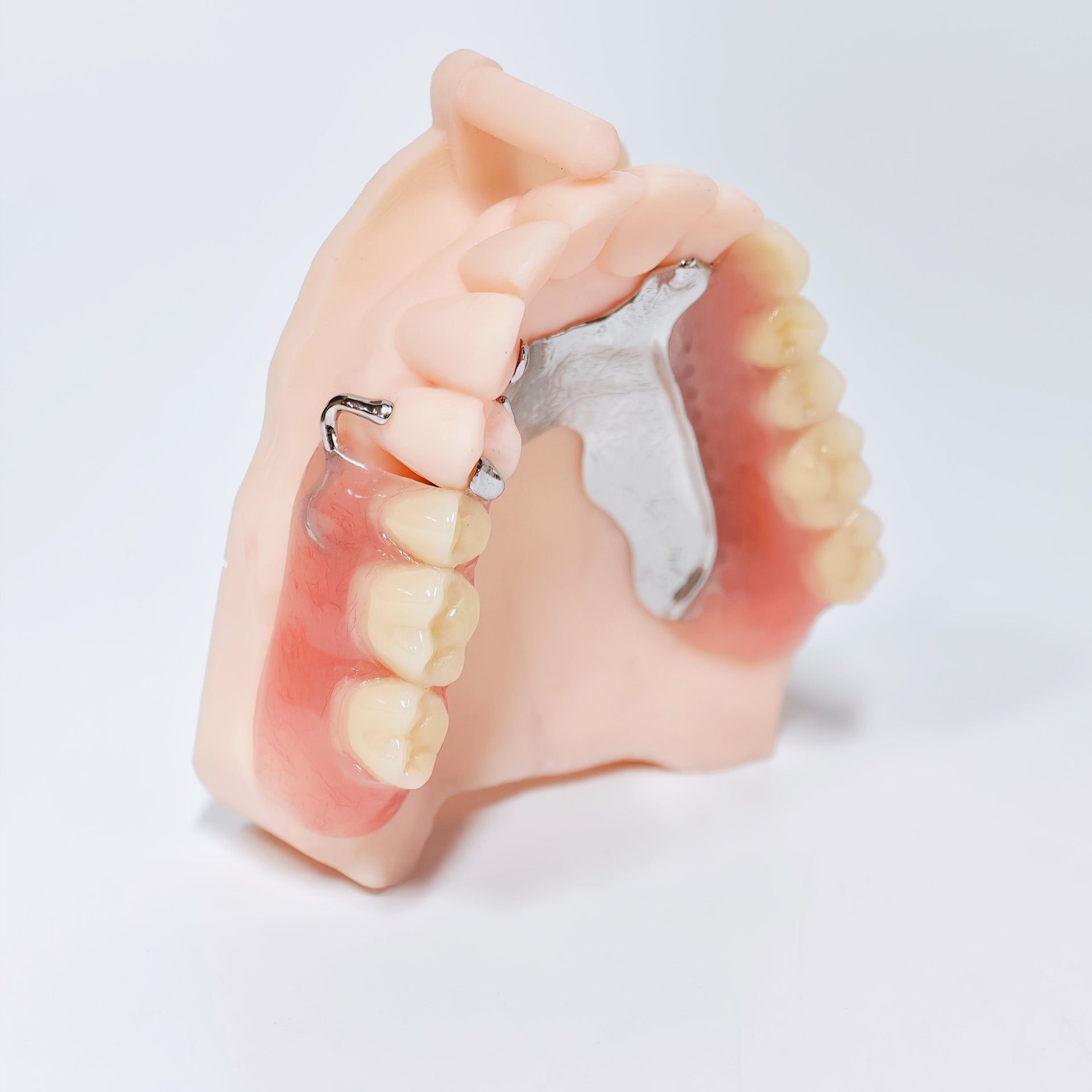 Cobalt Chrome Framework Denture Metal Framework With Acrylic Denture