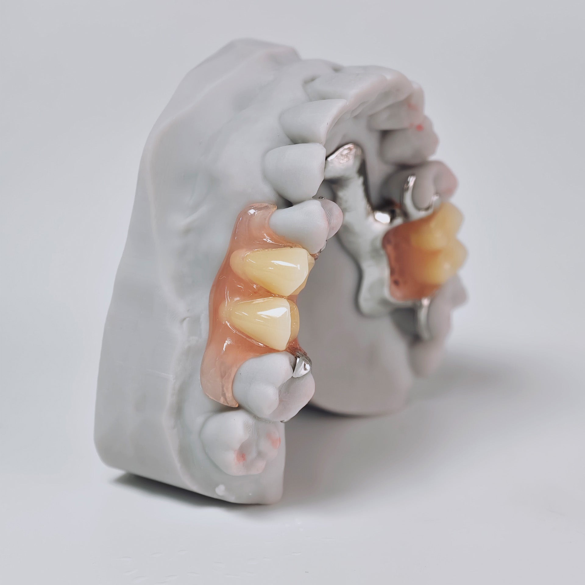 Cobalt Chrome Framework Denture Metal Framework With Acrylic Denture