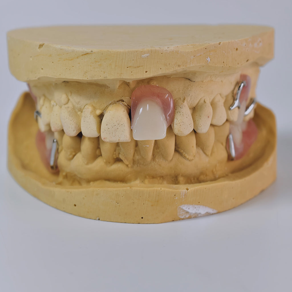 Cobalt Chrome Framework Denture Metal Framework With Acrylic Denture